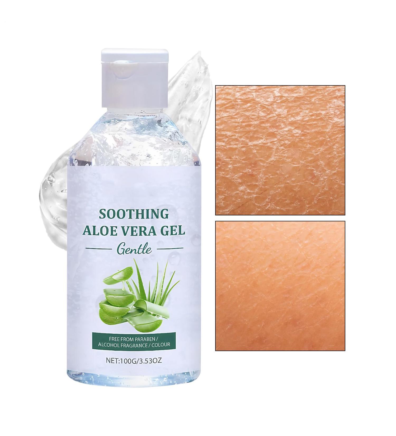 Moisturizing Gel - 100g Gentle Formula Face Gesl Nourishing Soothing Moisturizing Cream | Face Gel for Women Travel Care Against Sunburn by irr - Buy Online on GoSupps.com