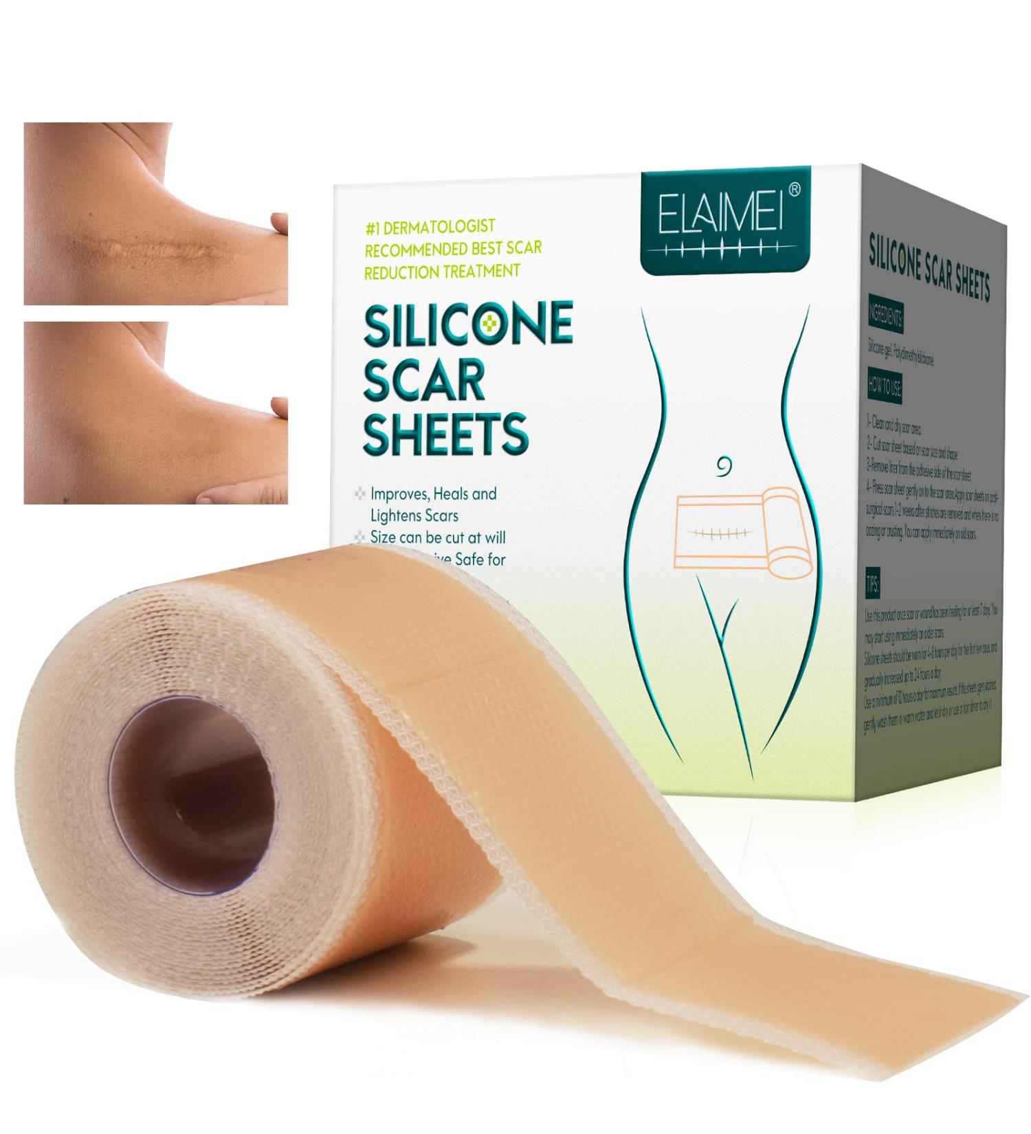 Soft Silicone Scar Sheets - Medical Grade, Waterproof & Reusable - 4CM x 300CM - Buy Online on GoSupps.com