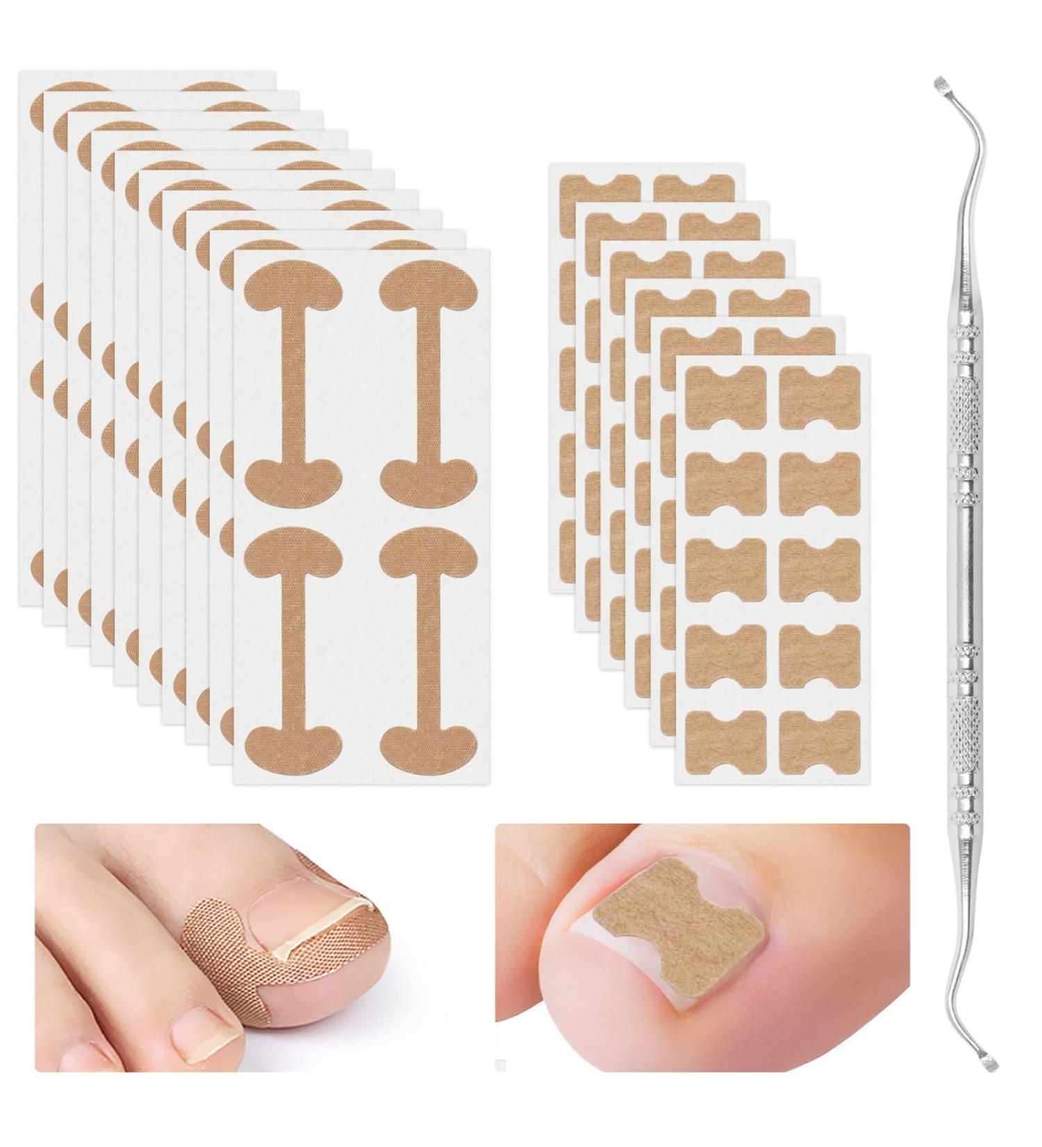 Xinzan 2 Types Ingrown Toenail Treatment Patch with Ingrown Toenail Tool Professional Ingrown Toenail Corrector Tools for Toenail Care Protect Toe Nail - Buy Online on GoSupps.com