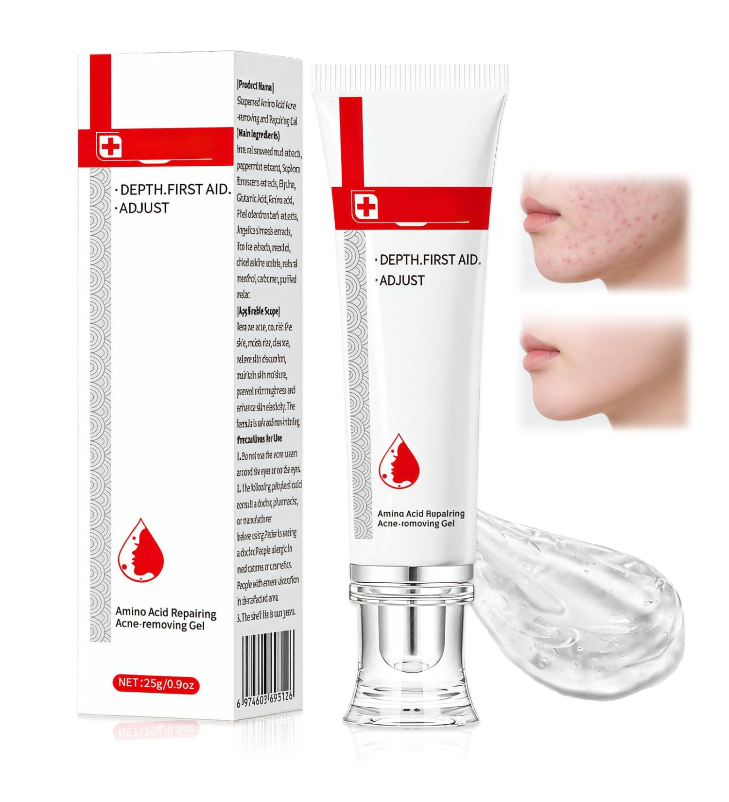 Tpubmity 25 g antiacne face cream acne removing gel antipimples immediate relief instantly cools and soothes reduces redness blue 25 g - Buy Online on GoSupps.com