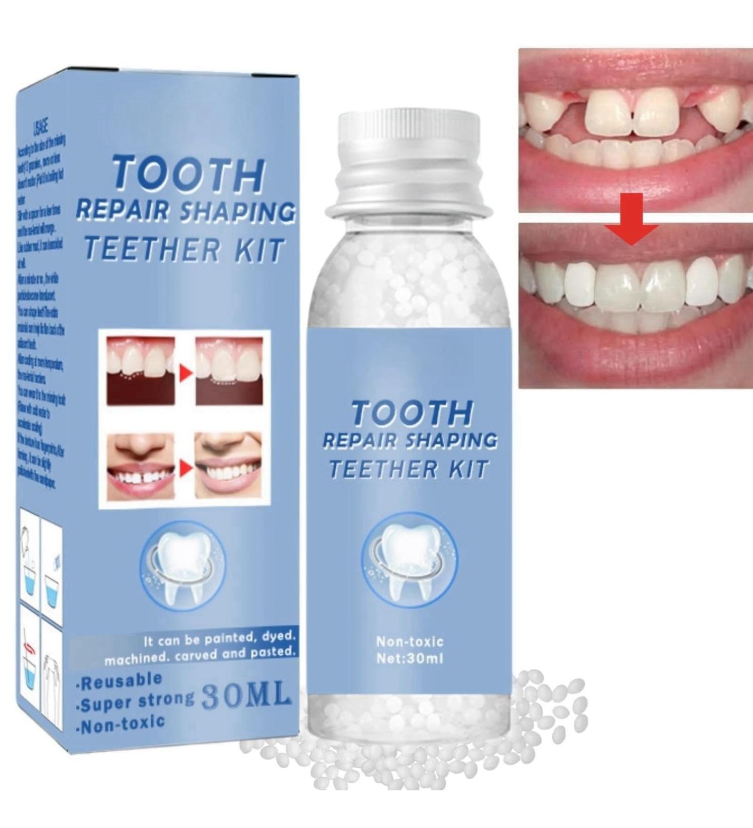 Temporary Tooth Filling Repair Kit - Moldable False Teeth Replacement | Tooth Repair Granules for Quick Fix | Fake Teeth Repair Beads - Buy Online on GoSupps.com