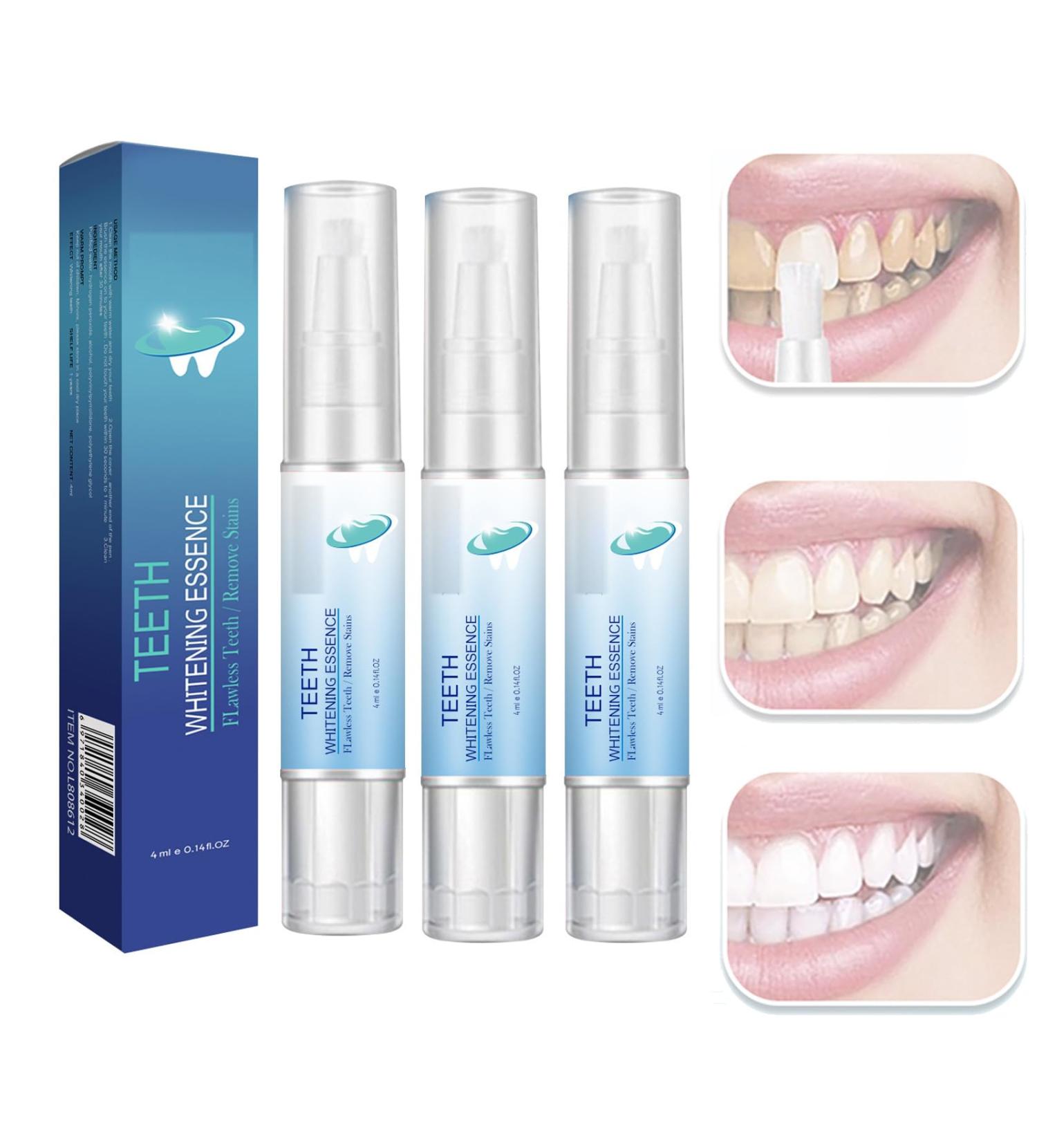 Pemarlis 3 Tooth Whitening Pen - Effective Teeth Stain Remover & Gums Restoration | Tooth-Friendly Bleaching for Whiter Teeth - Buy Online on GoSupps.com