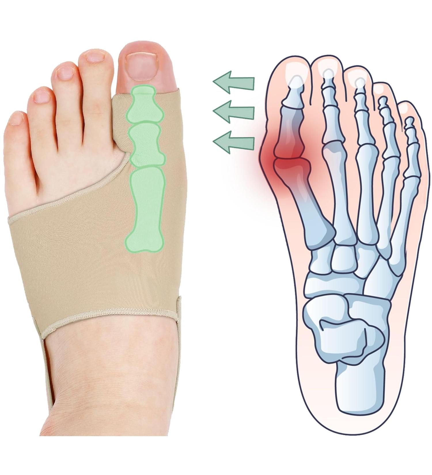 Bunion Corrector for Women & Men | Comfortable Toe Straightener Socks | Hallux Valgus Pain Relief | Breathable & Non-Slip Design - Buy Online on GoSupps.com