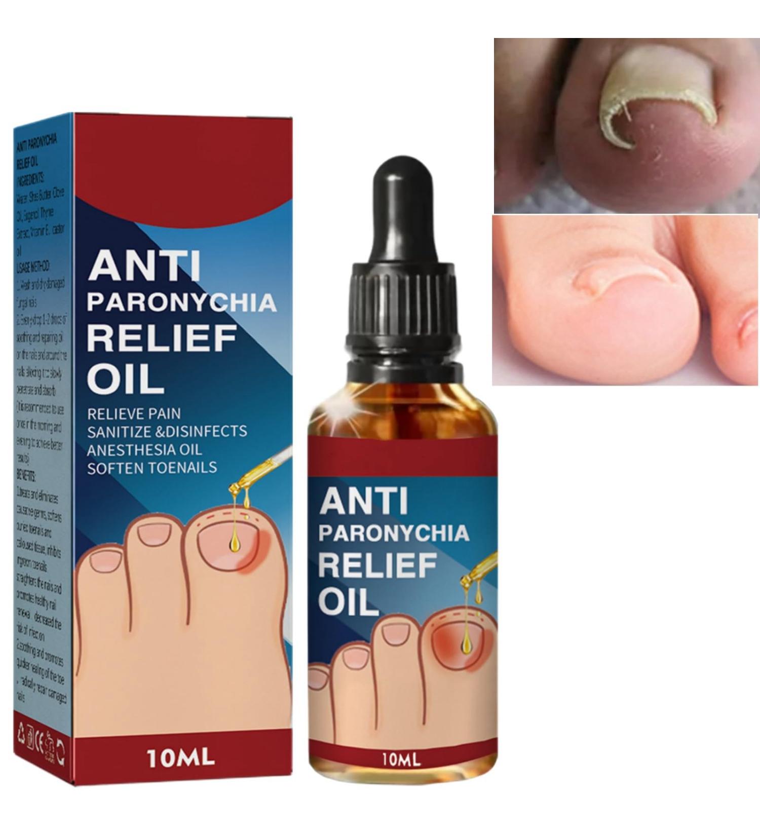 Ingrown Toenail Treatment Correction Drops Nail Growth Treatment Nail Care Ingrowing Toenail Treatment Ingrown Toenail Corrector Treatment for Ingrown Toenail Ingrowing Toenail Improve Toenail Health - Buy Online on GoSupps.com