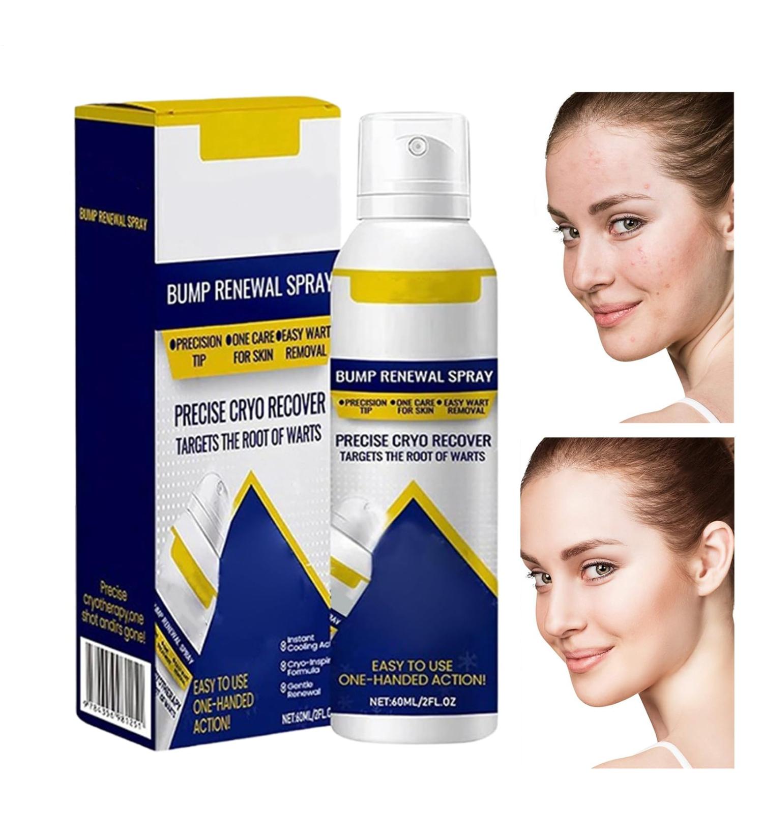  Monozoz Moisturizer for Dry Skin 60 ml Soothing and Repairing Solution Mist | Soothing Skin Spray for Men and Women for Blemishes Back Shoulders Arms Legs Hands - Buy Online on GoSupps.com