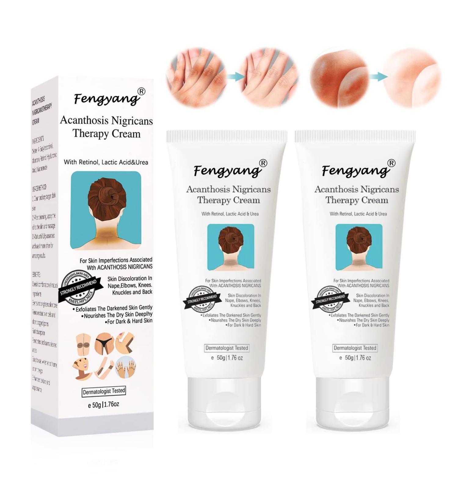 Fengyang Acanthosis Nigricans Cream Anti-Dark Spots Cream Correcting Cream for Elbow Knee Joint - Buy Online on GoSupps.com