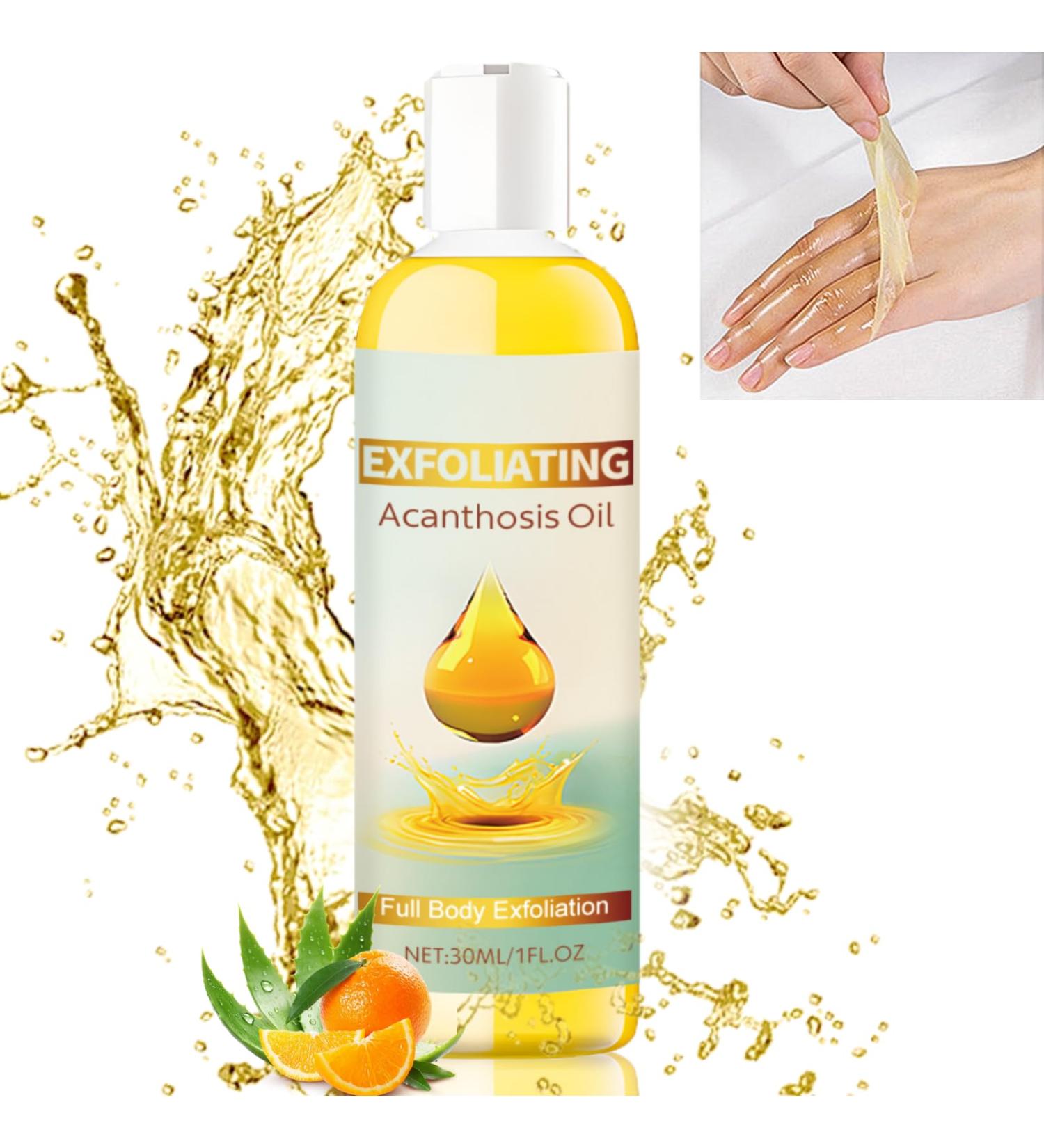 Exfoliating Acanthosis Peeling Oil Exfoliation Body Oil Peeling Solution Skin Peel Dark Spot Corrector Oil Yellow Peeling Oil Body Skin Care Exfoliation Oil Dark Spot Remover For Body Hand Feet - Buy Online on GoSupps.com