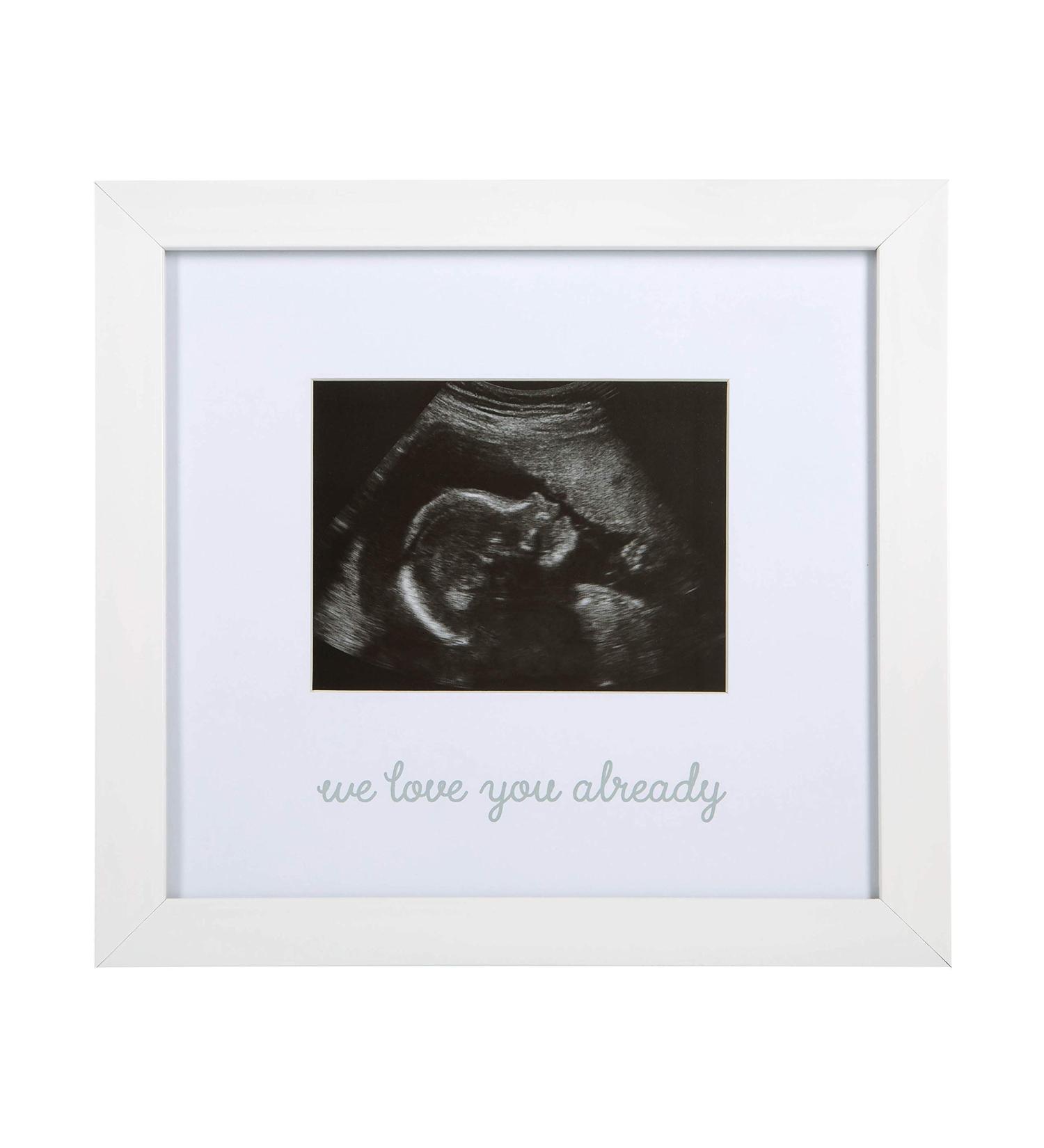 Kate & Milo Love at First Sight Ultrasound Picture Frame - White Keepsake Sonogram Frame for Expecting Parents - Buy Online on GoSupps.com