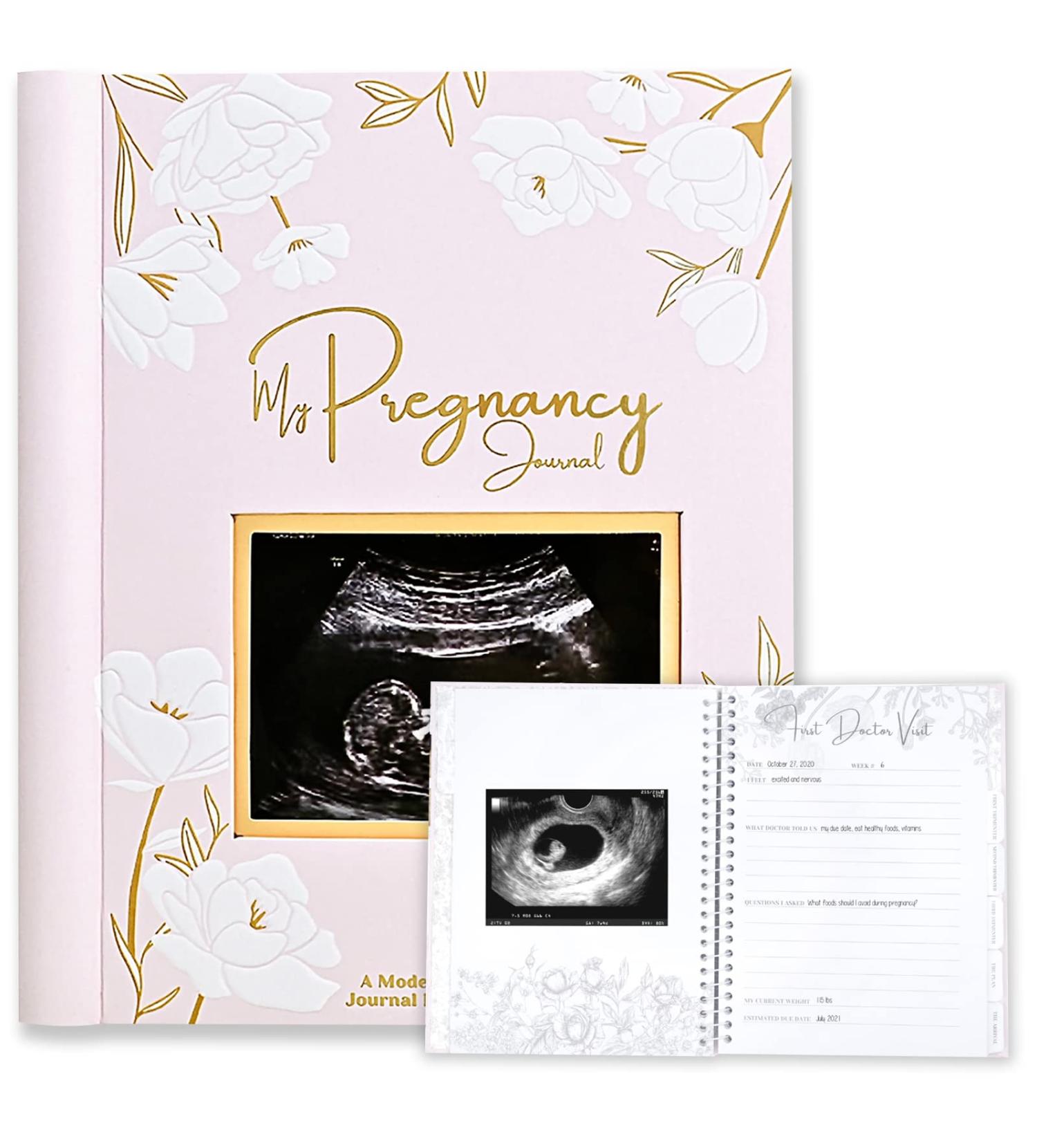 Pregnancy Journal - 80 Pages Hardcover Pregnancy Book for Mom to Be Gift - Pregnancy Announcements & Gifts for New Moms - Baby Album & Memory Book - Blossom Design - Buy Online on GoSupps.com
