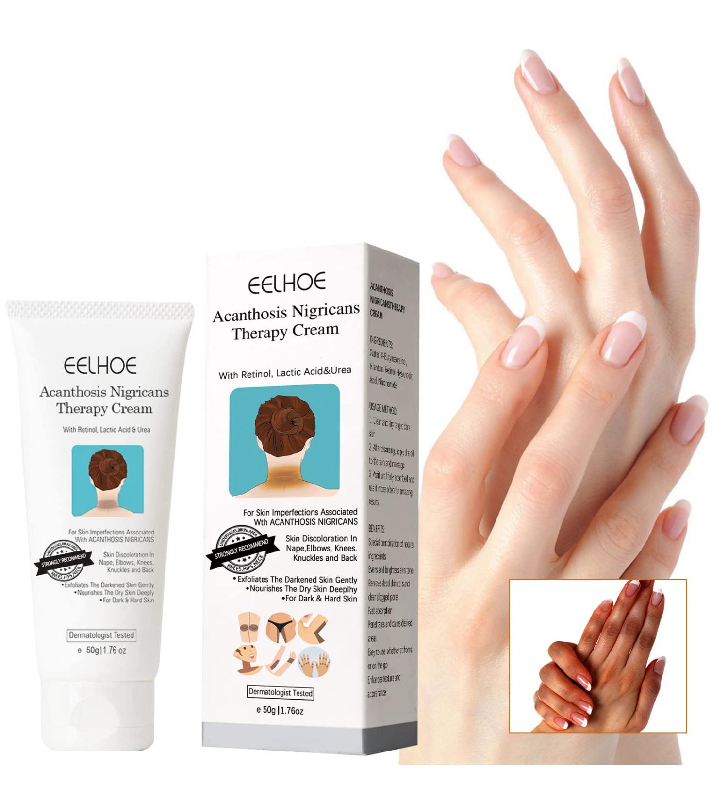 2Pcs Advanced Acanthosis Nigricans Treatment Body Cream - Dark Neck Cream for Damaged Skin - Exfoliating Therapy Oil - Buy Online on GoSupps.com