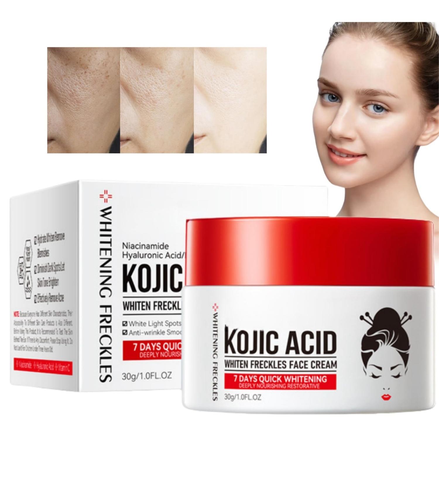 Kojic Acid Cream Dark Spot Remover for Face Skin Lightening Cream for Anti Aging Dark Spot Correcting Glow Serum Face Moisturizer for Women Pigmentation Removal Cream Freckle Removal Cream Dark Spots - Buy Online on GoSupps.com