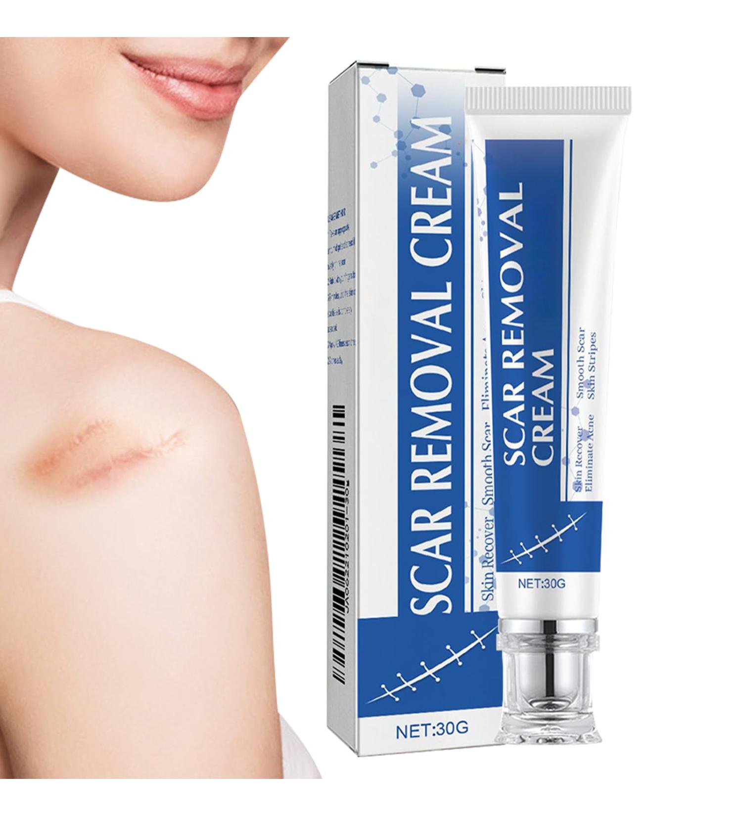 Scars Burns Cream - 30g Moisturizing Product for Scratching Marks - Reducing Cream for Old Scars - For Recovery of Cheloid Wounds Women Men Athletes - Buy Online on GoSupps.com