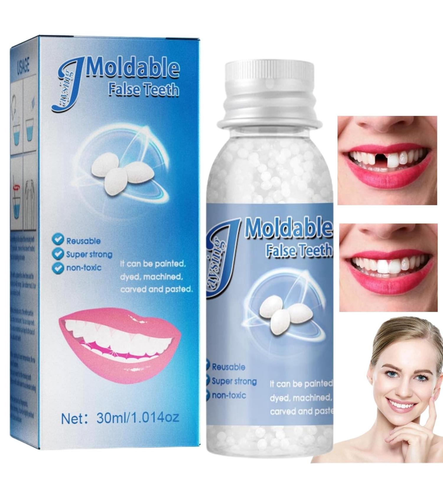 Dental Repair Kit - Temporary Tooth Filling Beads for DIY Fixing Thermal Forming Teeth Repair - False Teeth Moldable Granules - Dental Bridge Repair Solution - Buy Online on GoSupps.com