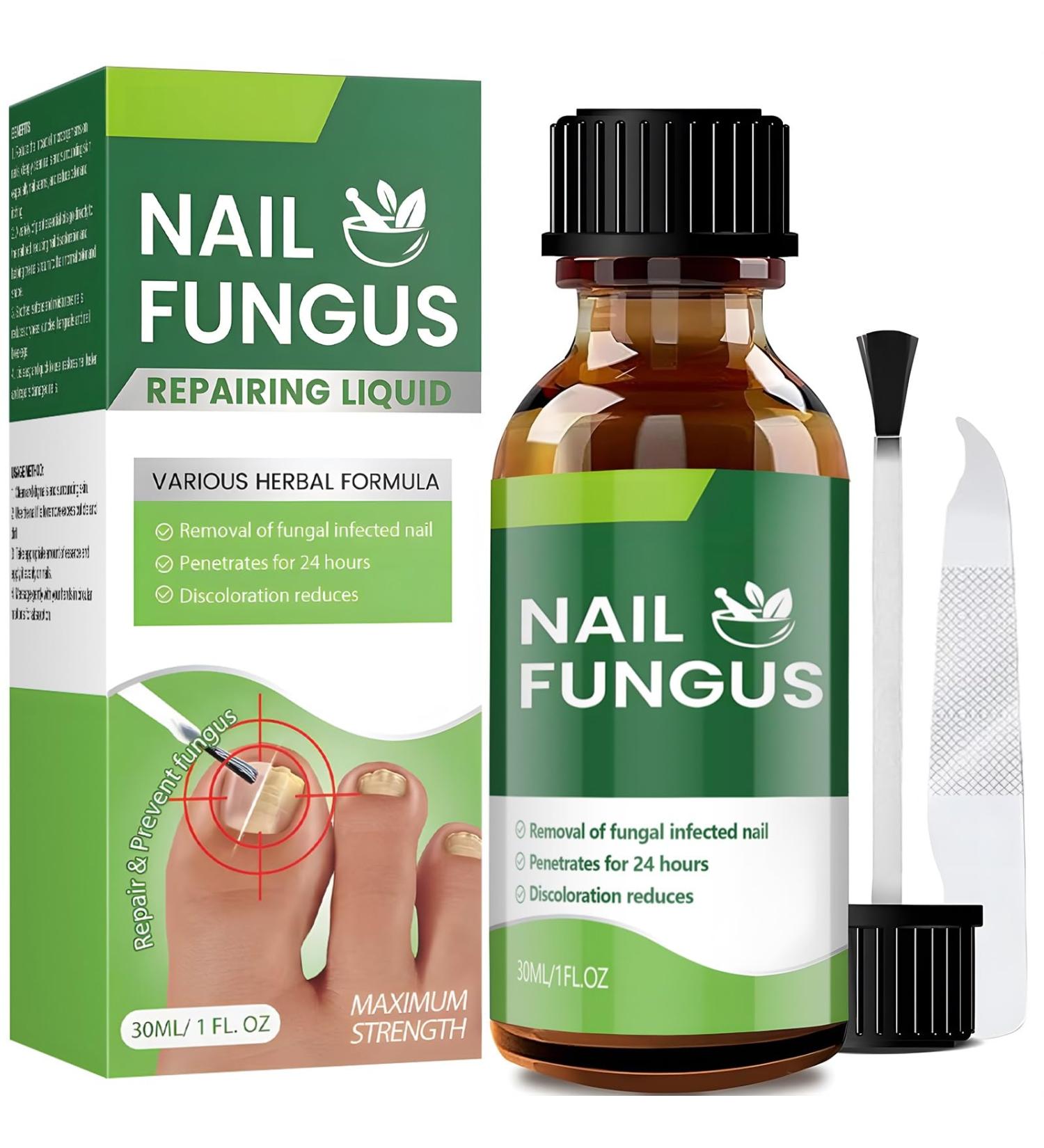 Extra Strength Toenail Fungus Treatment - 30ml | Effective Nail Fungus Solution for Thick Broken & Discolored Nails - Fast Shipping Internationally - Buy Online on GoSupps.com