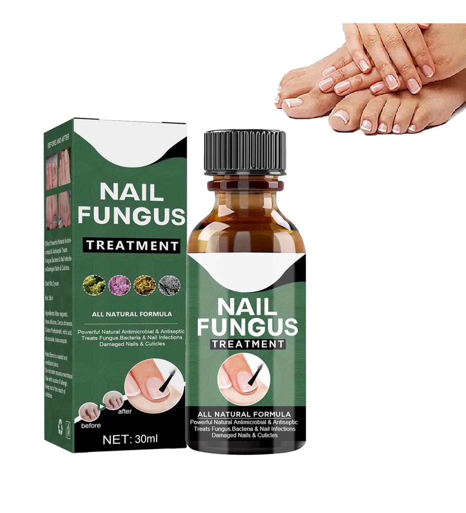 Antifungal Nail Treatment for Damaged Nails - Toe Care Solution for Renewing Discolored Feet - Buy Online on GoSupps.com