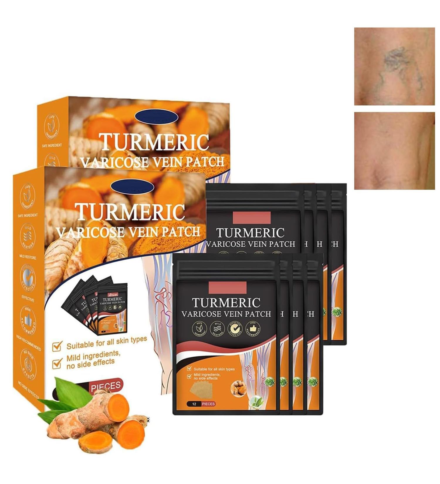 Patch Anti Varices 2x 48pcs patchs Varicose Veins Patch Varices Jambe Soulager Gonflement Varices Traitement Jambe pour Les Jambes limine Les Varices et Les Varicosit s - Buy Online on GoSupps.com