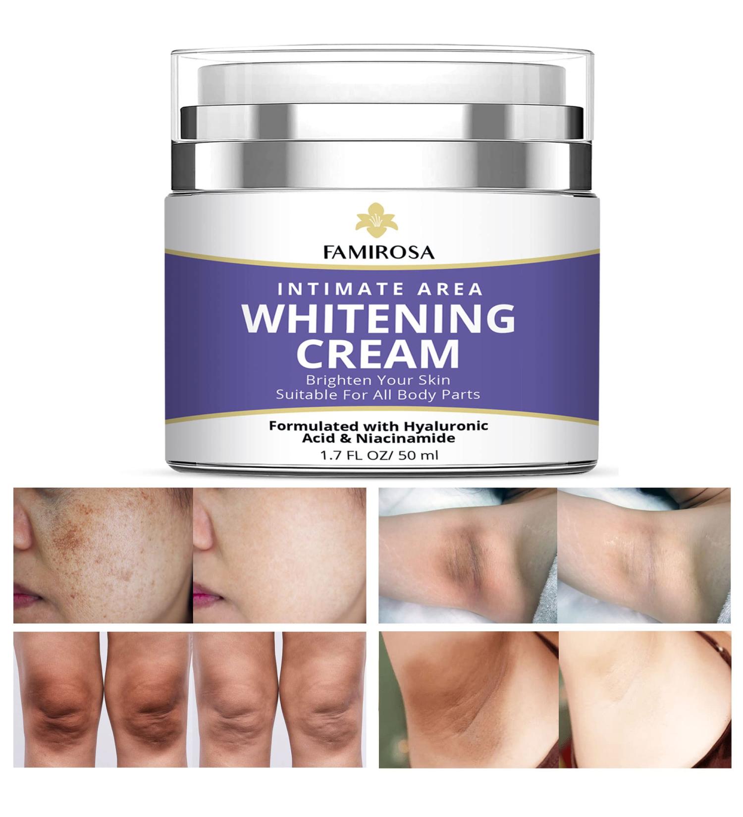 Intimate Area Dark Spot Corrector - Underarm, Knees, Elbows, Thighs, Private Parts Cream - Buy Online on GoSupps.com