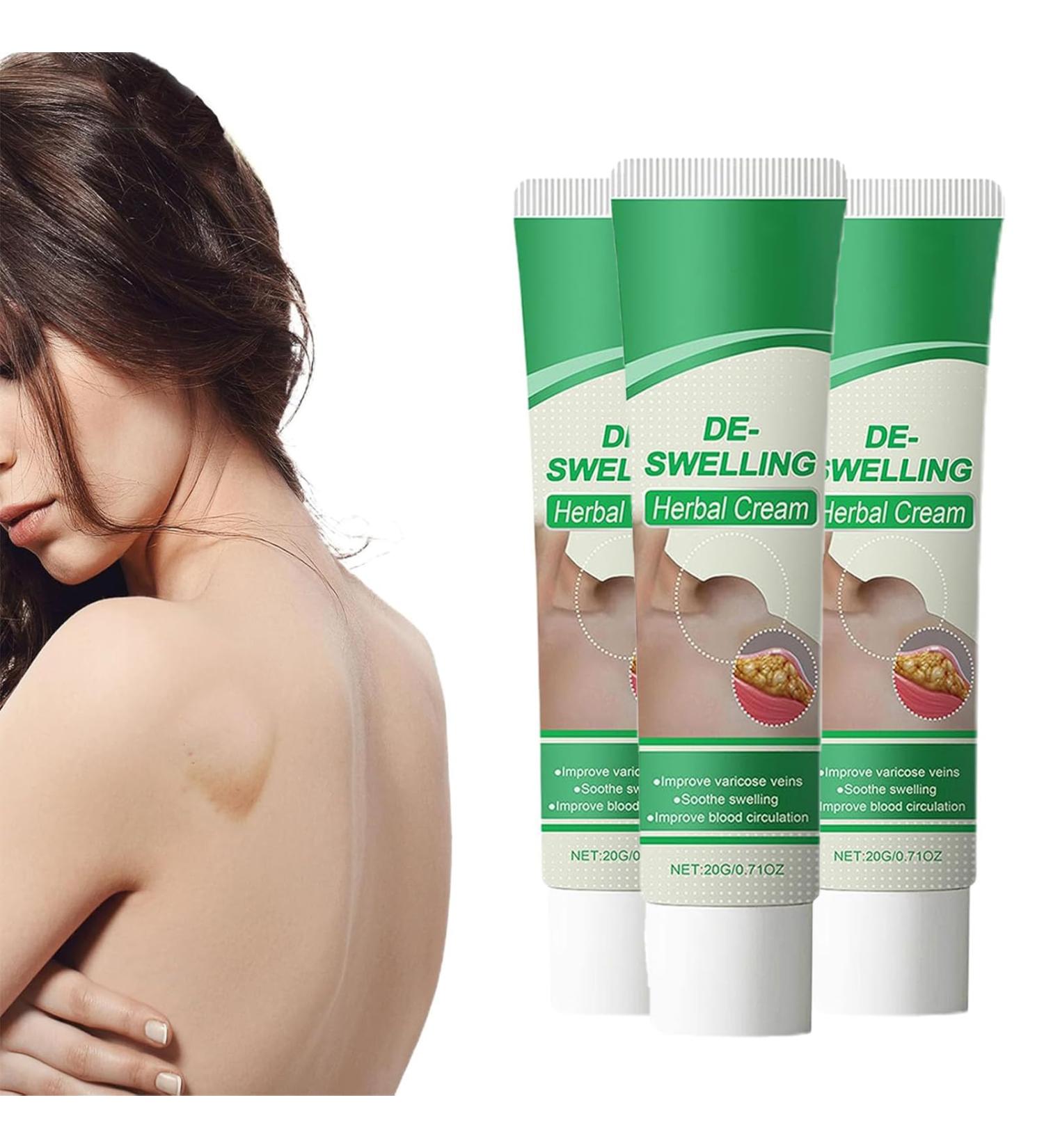 Cr me d toxifiante lymphatique aux herbes cr me lymphatique cr mes naturelles anti-gonflements pour les jambes lotion apaisante anti-cellulite rapide pour les jambes le cou et les aisselles (3pcs) - Buy Online on GoSupps.com