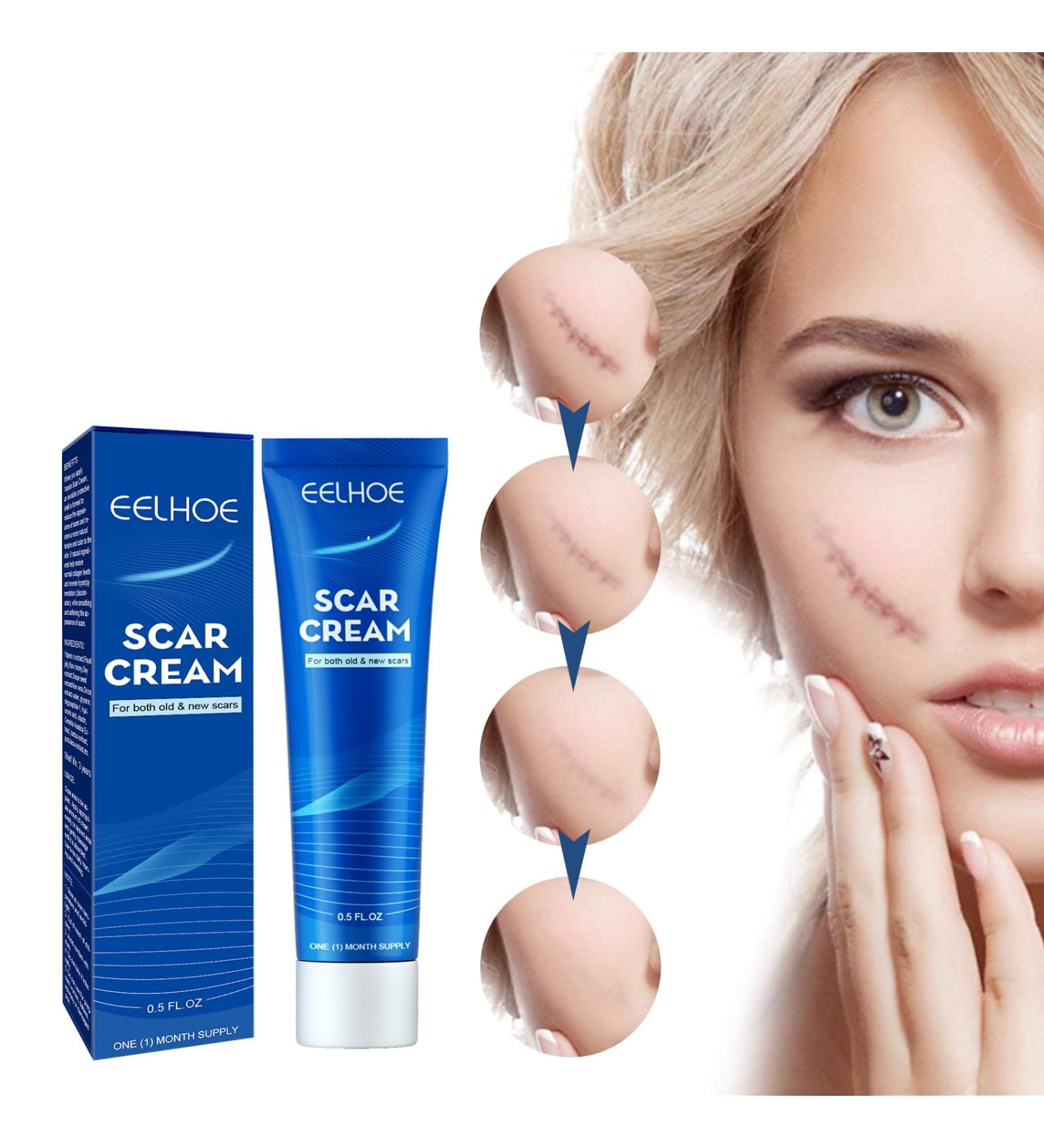 Best Scar Cream for All Types | Scar Angel - Effective Silicone Ointment for Stretch Marks & Post-Op Care - Buy Online on GoSupps.com