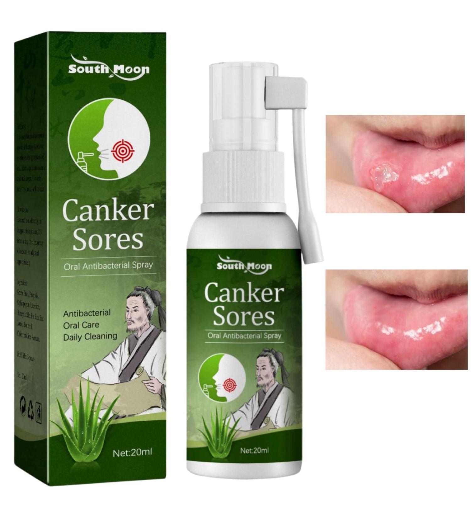 Mouth Ulcer Treatment Spray Mouth Ulcer Spray Mouth Ulcer Relief Spray Canker Sore Treatment Ulcer Treatment Tongue Breath Spray for Bad Breath Ulcer Treatment Canker Relief Spray Mouth Freshener - Buy Online on GoSupps.com