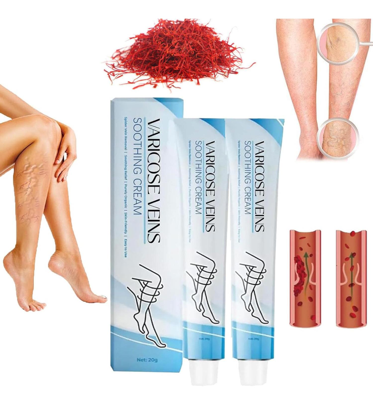 Varicose Veins Treatment Cream Raura Varicose Veins Treatment Cream Raura Varicose Veins Cream Cream for Varicose Veins Ointment for Varicose Veins Varicose Veins Cream (2pcs) - Buy Online on GoSupps.com