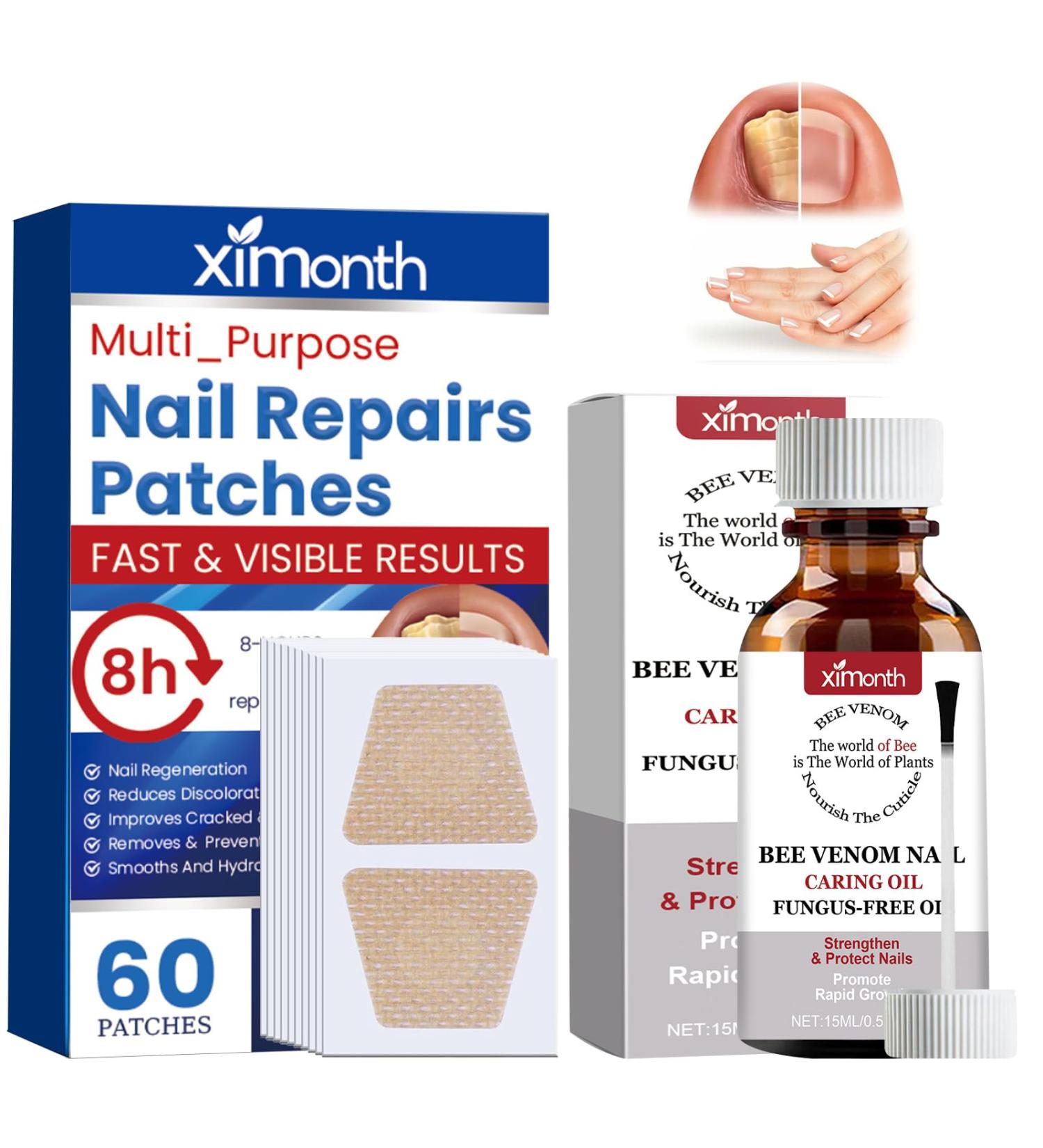 TaimeiMao 60 pieces nail digging repair patches 15 ml nail soft foot nails split nail repair strengthening nails nail digging repair patches for damaged nails and the appearance of - Buy Online on GoSupps.com