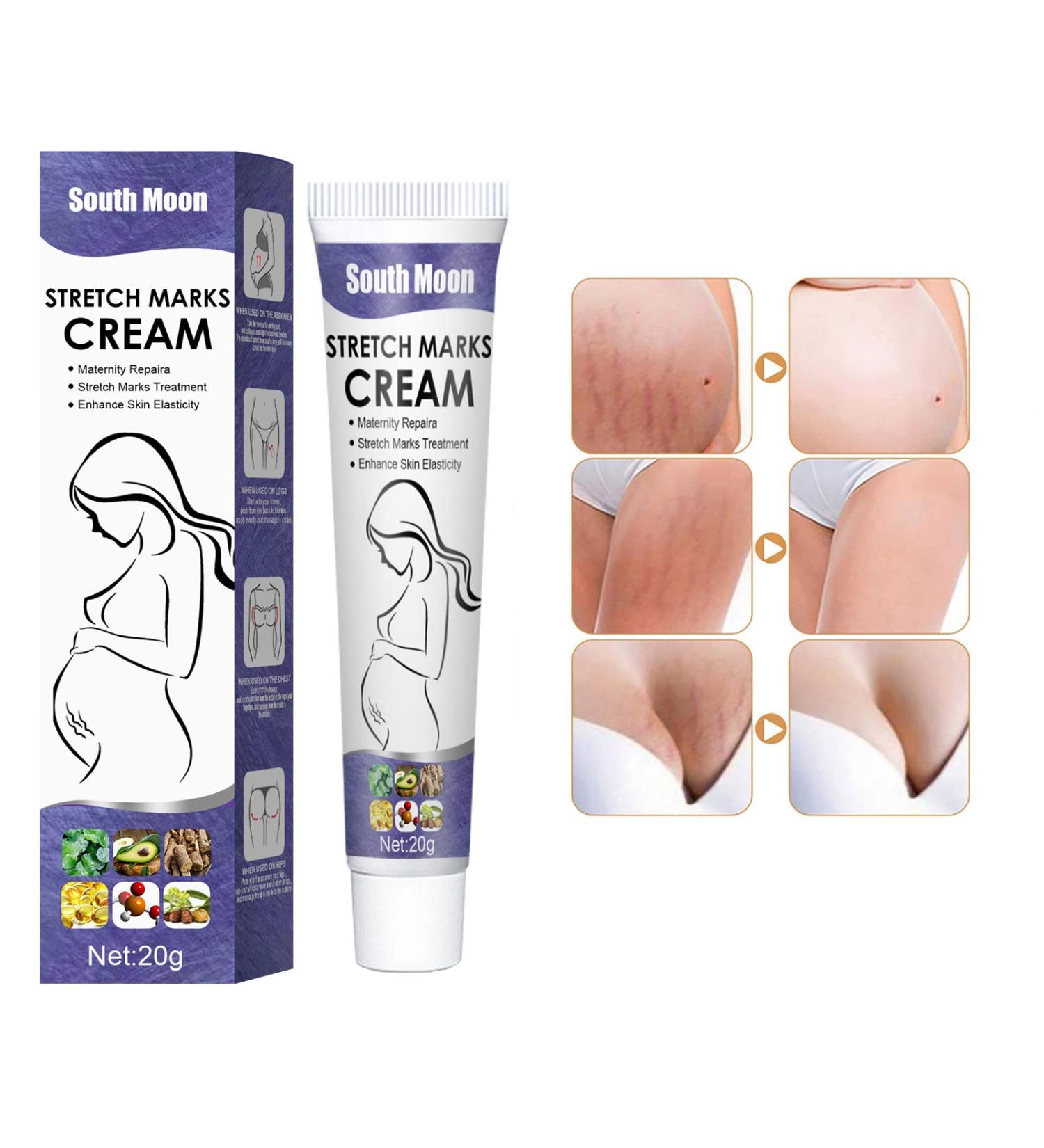 SINGOVE Scar Removal Cream - All-Natural Maternity Stretch Mark Prevention & Remover for Pregnant Women - Fades Scars, Wrinkles & Promotes Healthy Skin - Perfect Skincare Gift for Moms - One Size - Buy Online on GoSupps.com