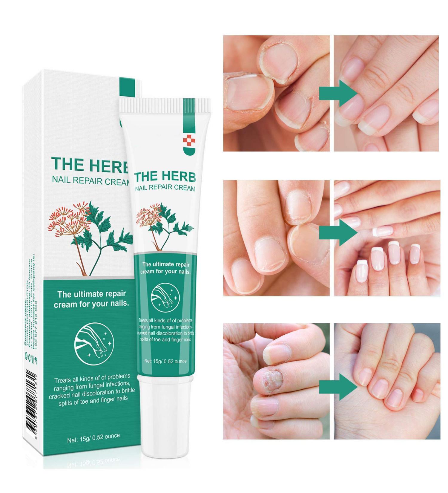 Maximum Strength Nail Repair Cream - Treat Toenail Fungus, Repair Damage & Discoloration, Restore Healthy Nails - Buy Online on GoSupps.com