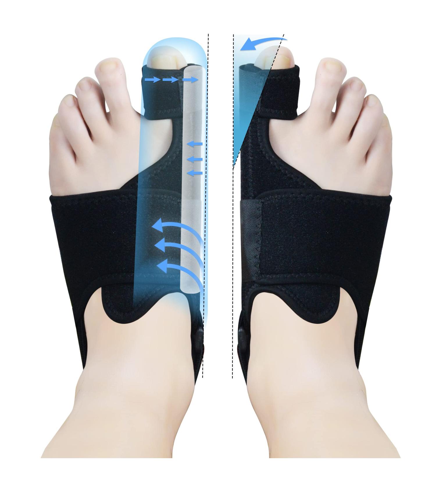 MOONSMILE Bunion Corrector for Women & Men - V-F-006 Black62 - Buy Online on GoSupps.com