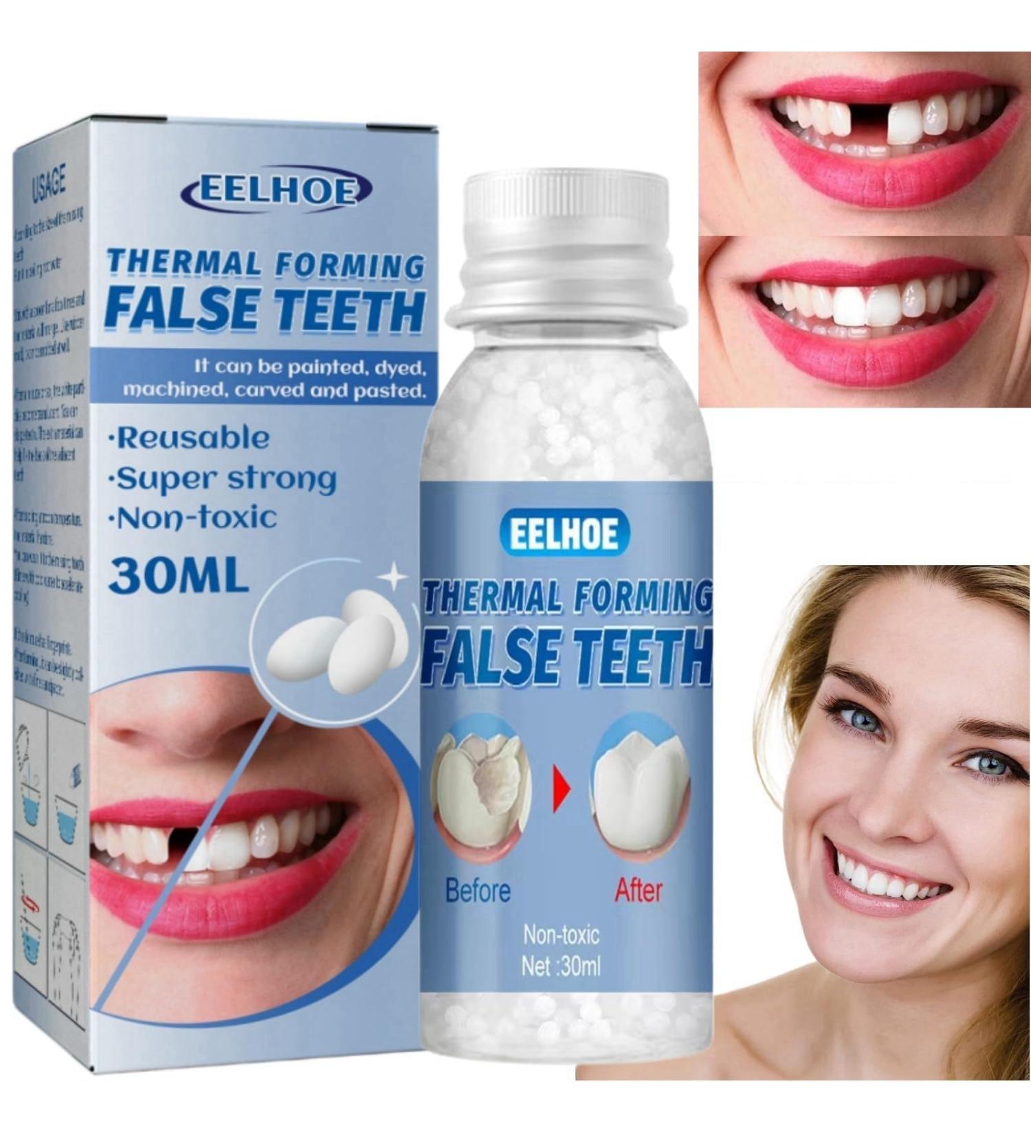 Temporary Tooth Filling Kit for Missing or Broken Tooth Repair | Moldable False Teeth Replacement Solution - Buy Online on GoSupps.com