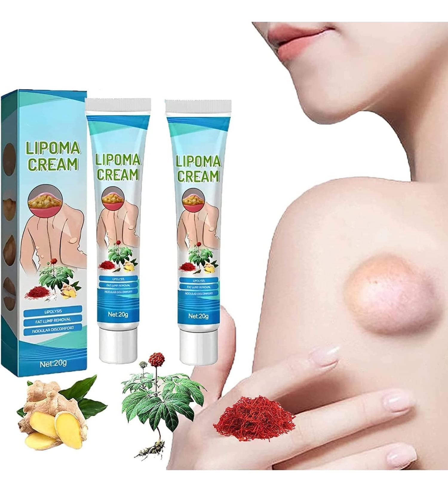 Lipoma Removal Cream Cr me d' limination de lipomes Cellulite Removal Exfoliating Cream Get Rid of Your Fatty Lipoma Lumps (2pcs) - Buy Online on GoSupps.com