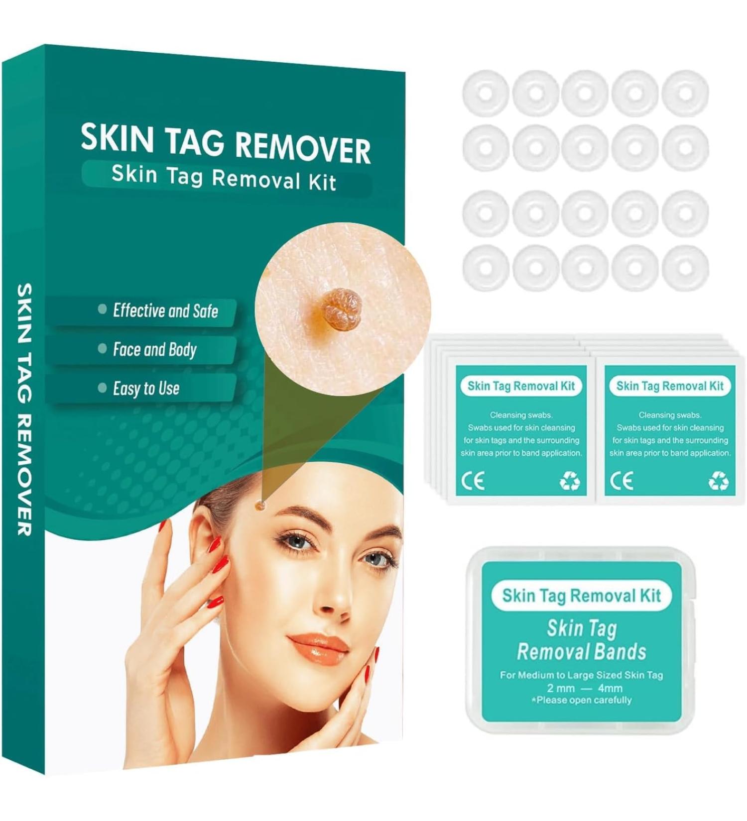 Standard Skin Tag Tool Kit Quick Solution for Medium to Small Skin Tags Complete Skin Tag Tool Kit for Fast Results (2mm-5mm) - Buy Online on GoSupps.com
