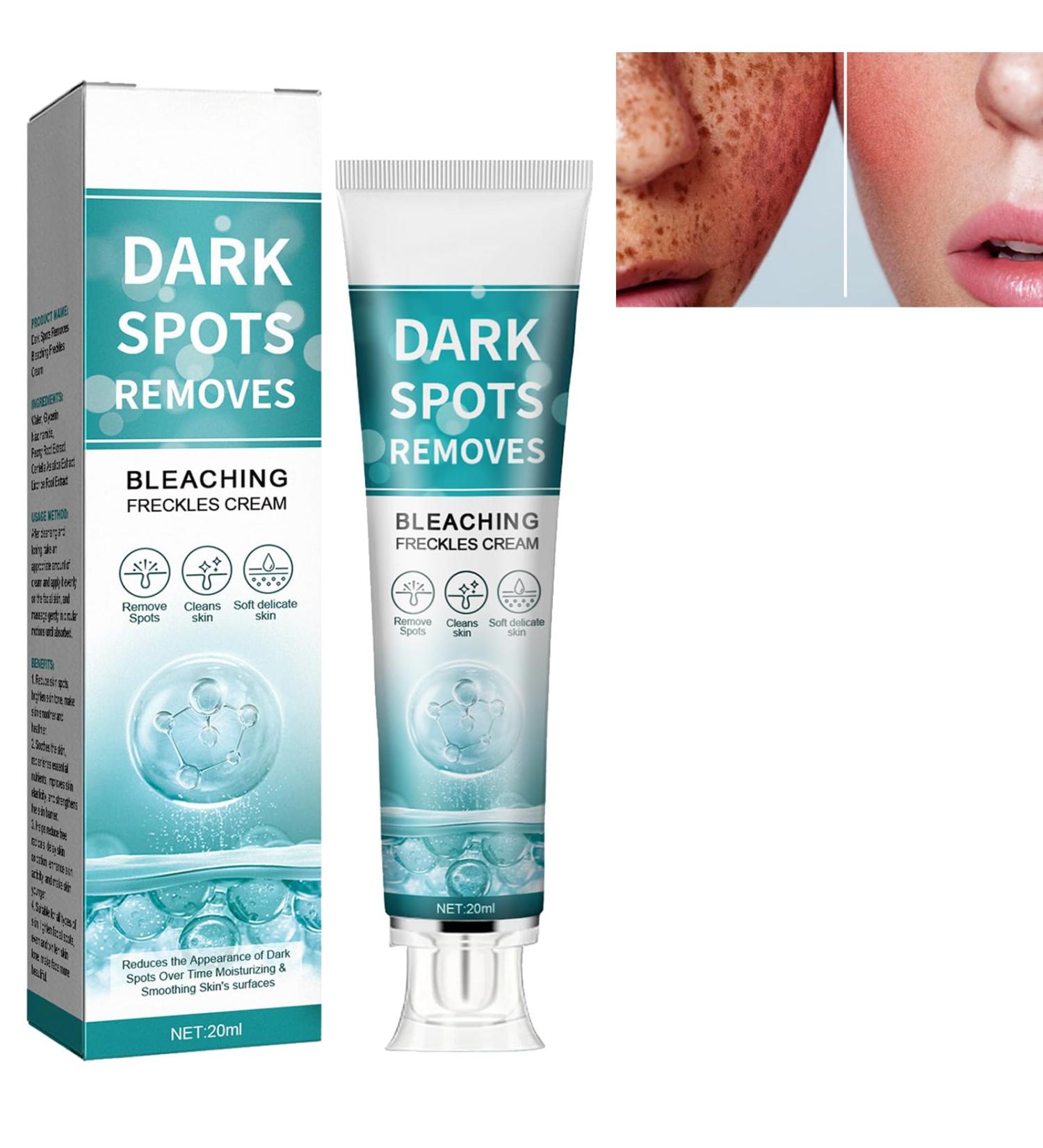 KOAHDE Fade Stain Beauty Cream Dark Spot Remover for Face and Body Freckle Remover Cream Skin Brightening Moisturizing Face Serum Dark Spot Correcting Glow Serum Corrector Cream for Face and Body - Buy Online on GoSupps.com