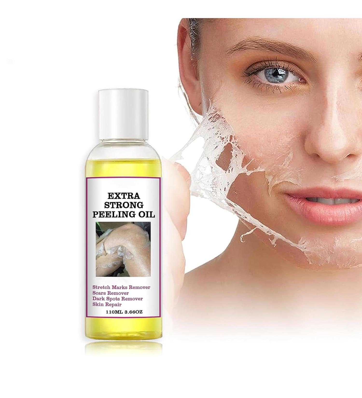 Extra Strength Yellow Peeling Oil | Exfoliating Solution for All Skin Types - Dark Skin Dead Skin Remover (3.87 Fl Oz / 110ML - Buy Online on GoSupps.com