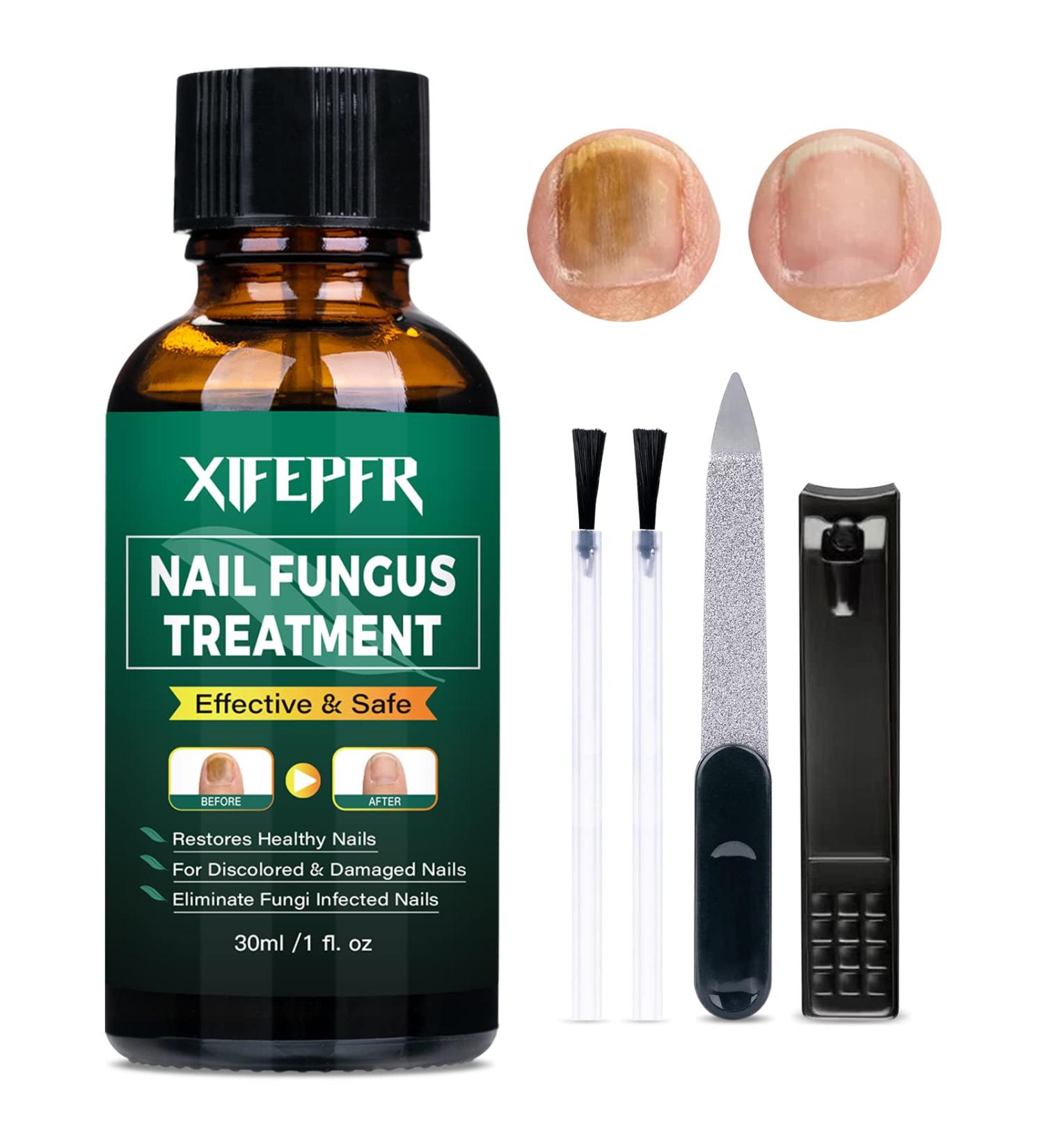 XIFEPFR Toenail Repair Treatment - Extra Strength Nail Renewal Solution for Thick, Brittle, and Discolored Nails - Buy Online on GoSupps.com