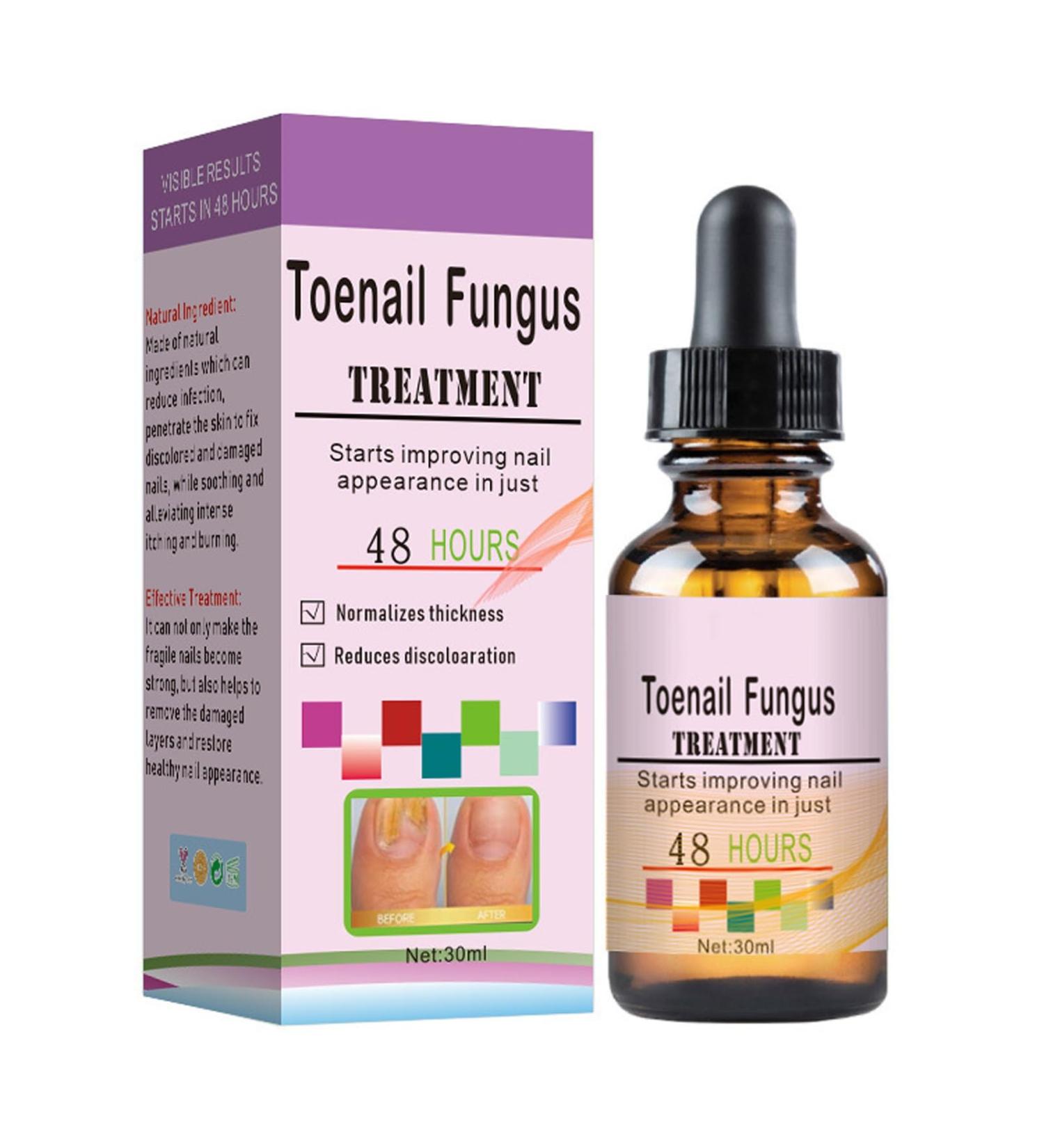 Fungal Nail Treatment - Toe Nail Fungal Treatment - Nail Fungus Treatment for Toenail and Fingernails - Anti fungus Nail Repair and Strengthen Fix & Renew Damaged Broken Nails - Buy Online on GoSupps.com
