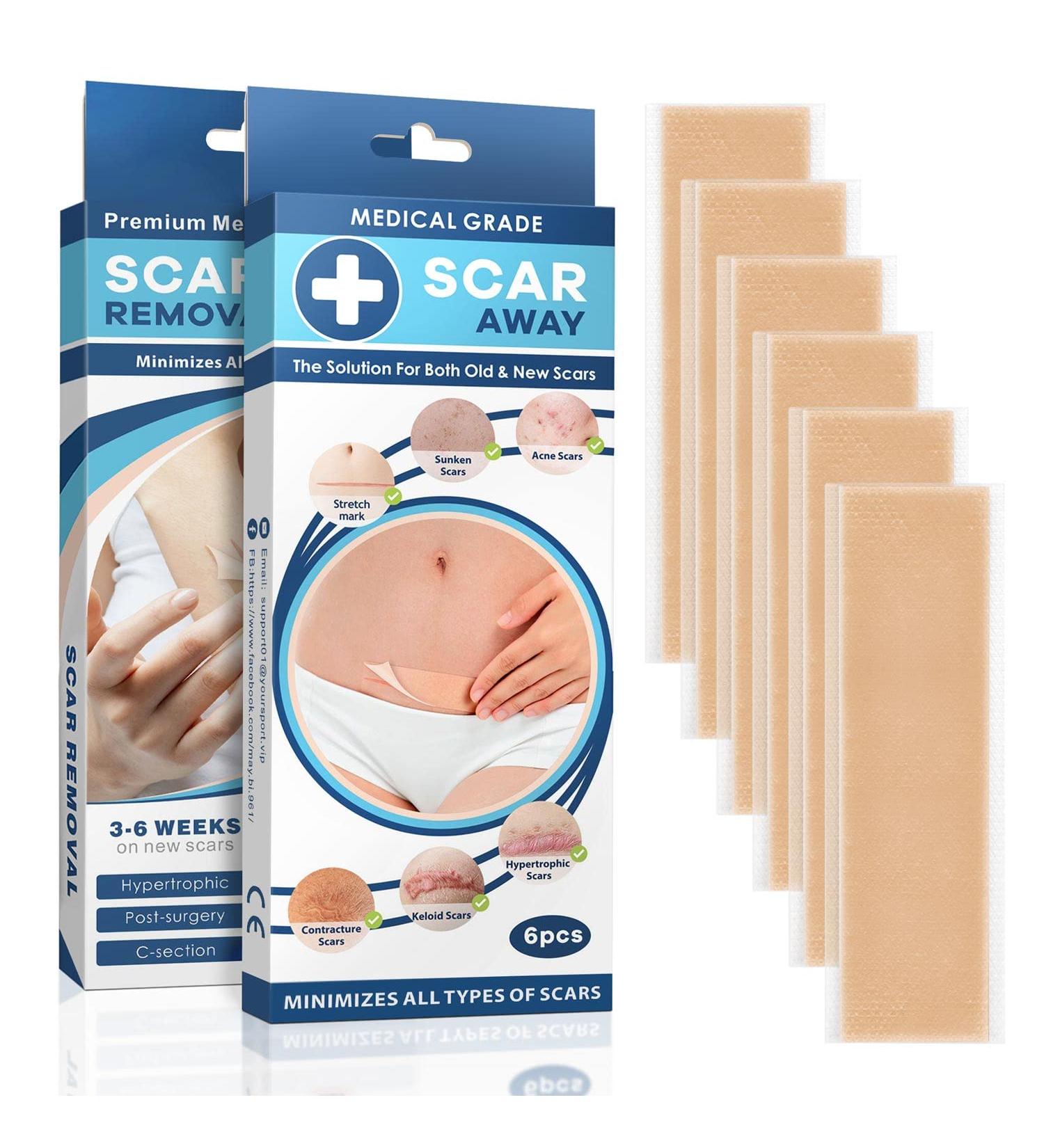 ScarAway Silicone Scar Sheets - 6 Pack for Healing Keloid, C-Section, Tummy Tuck & Surgery Scars - 5.7x1.57 Inch - Treatment for Stretch Marks - Buy Online on GoSupps.com