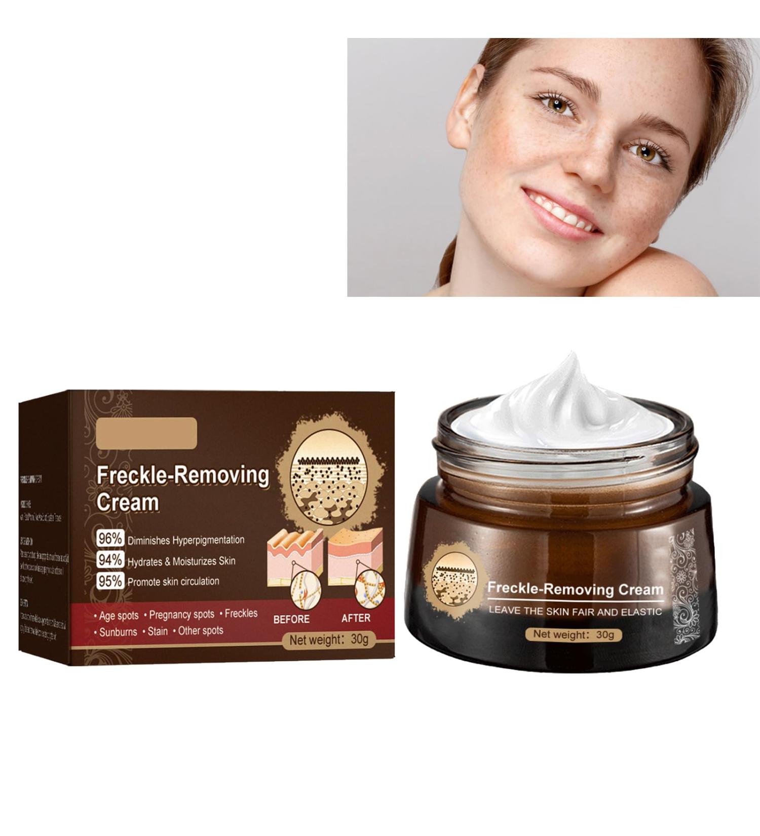 KOAHDE Freckle Removal Cream For Face Freckle Cream Anti Melasma Facial Moisturize Cream Moisturizing Anti-Blemish Cream Pigmentation Removal Cream for Face Skin Brightening Cream Dark Spot Corrector - Buy Online on GoSupps.com