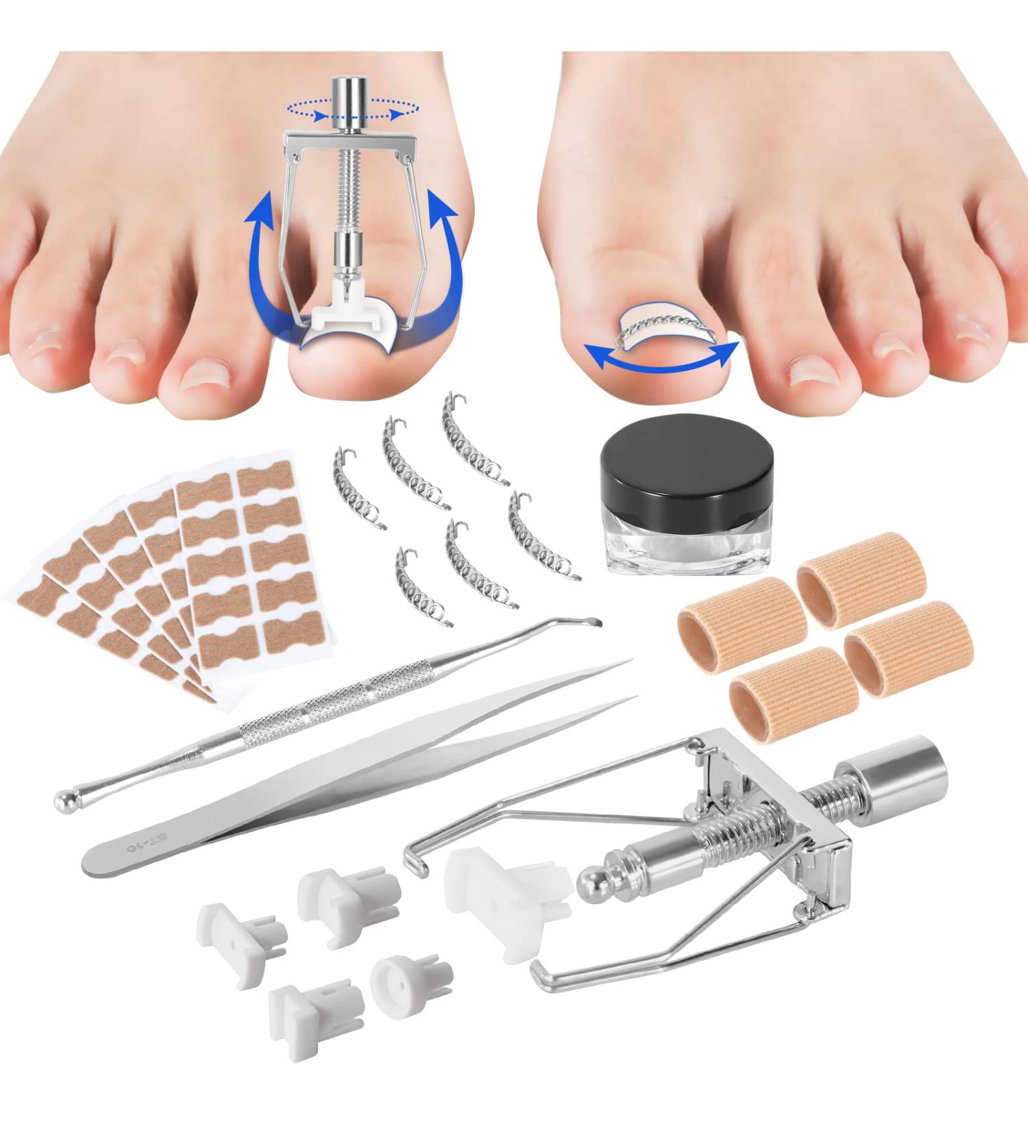 Ingrown Toenail Treatment Kit with 12 Podiatry Braces | Corrector Tool & 50pcs Patch | 10 Strips | White - Buy Online on GoSupps.com