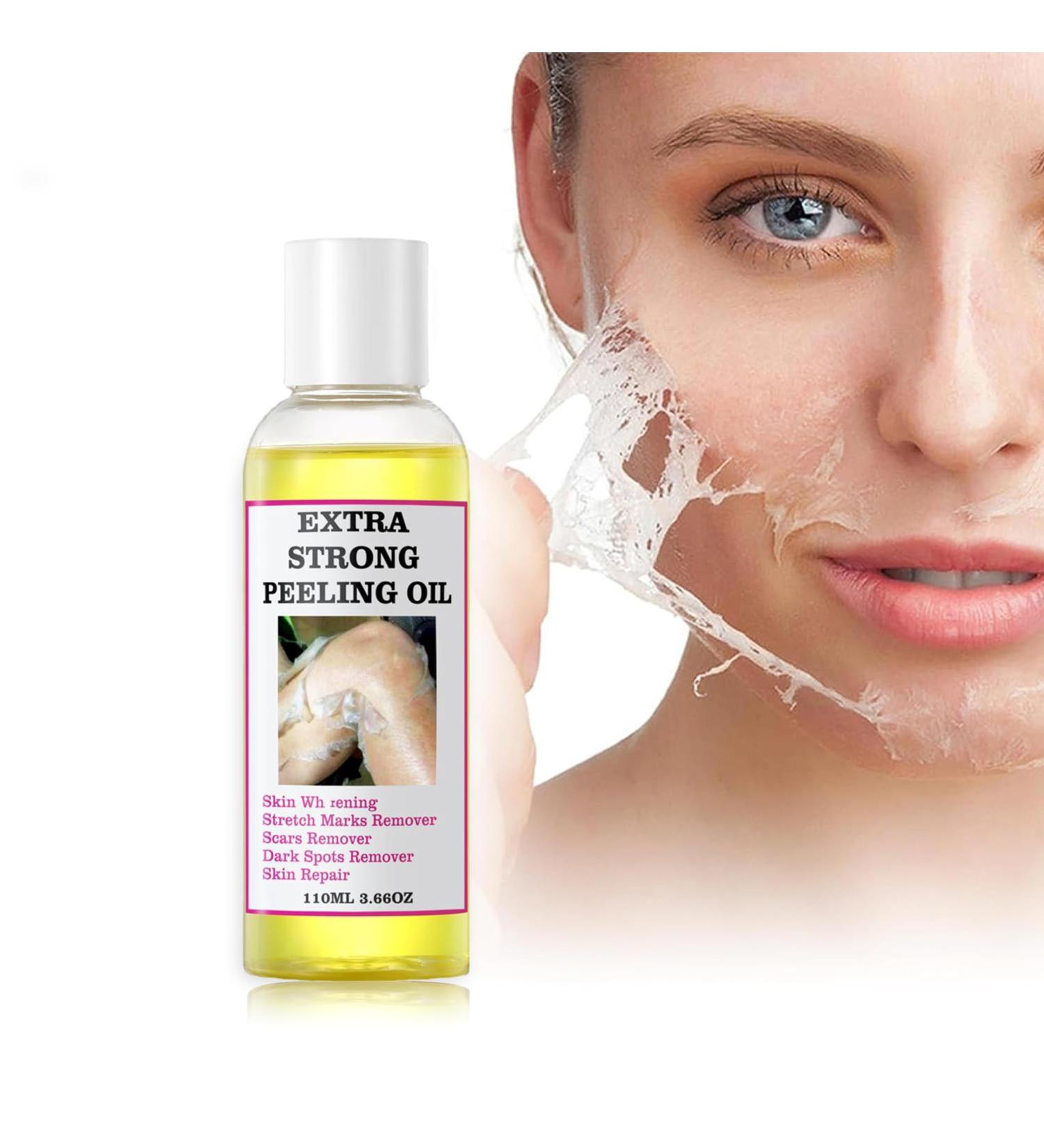 Yellow Peeling Oil - Extra Strength Chemical Peel for Dark Skin & All Skin Types | Exfoliating Solution 1 Bottle - Buy Online on GoSupps.com