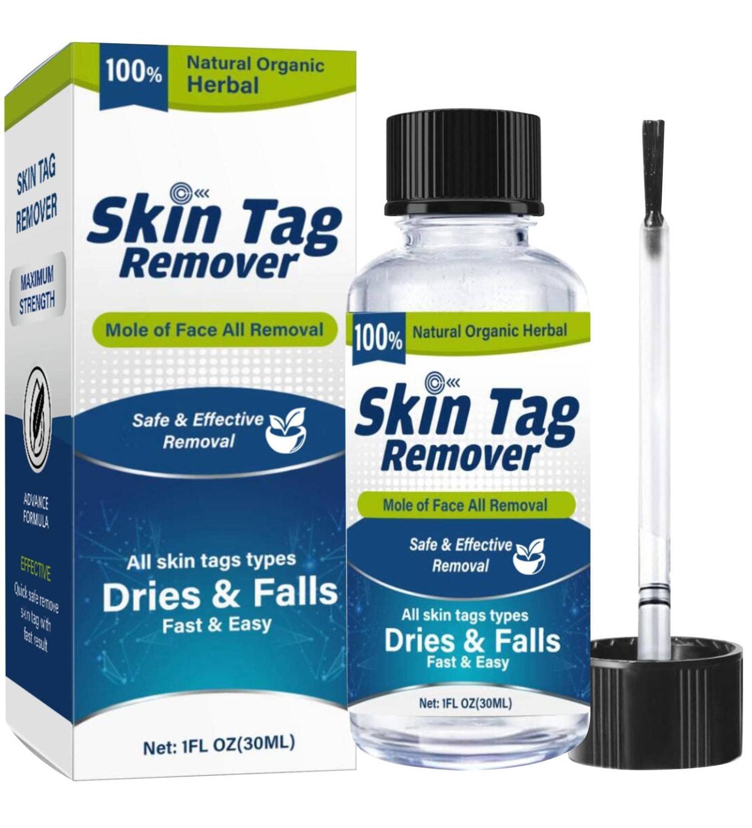 Zacurate Skin Tag Remover & Wart Mole Verruca Treatment Lotion - Fast-Acting Blue Formula - 30ML (Pack of 1) - Buy Online on GoSupps.com