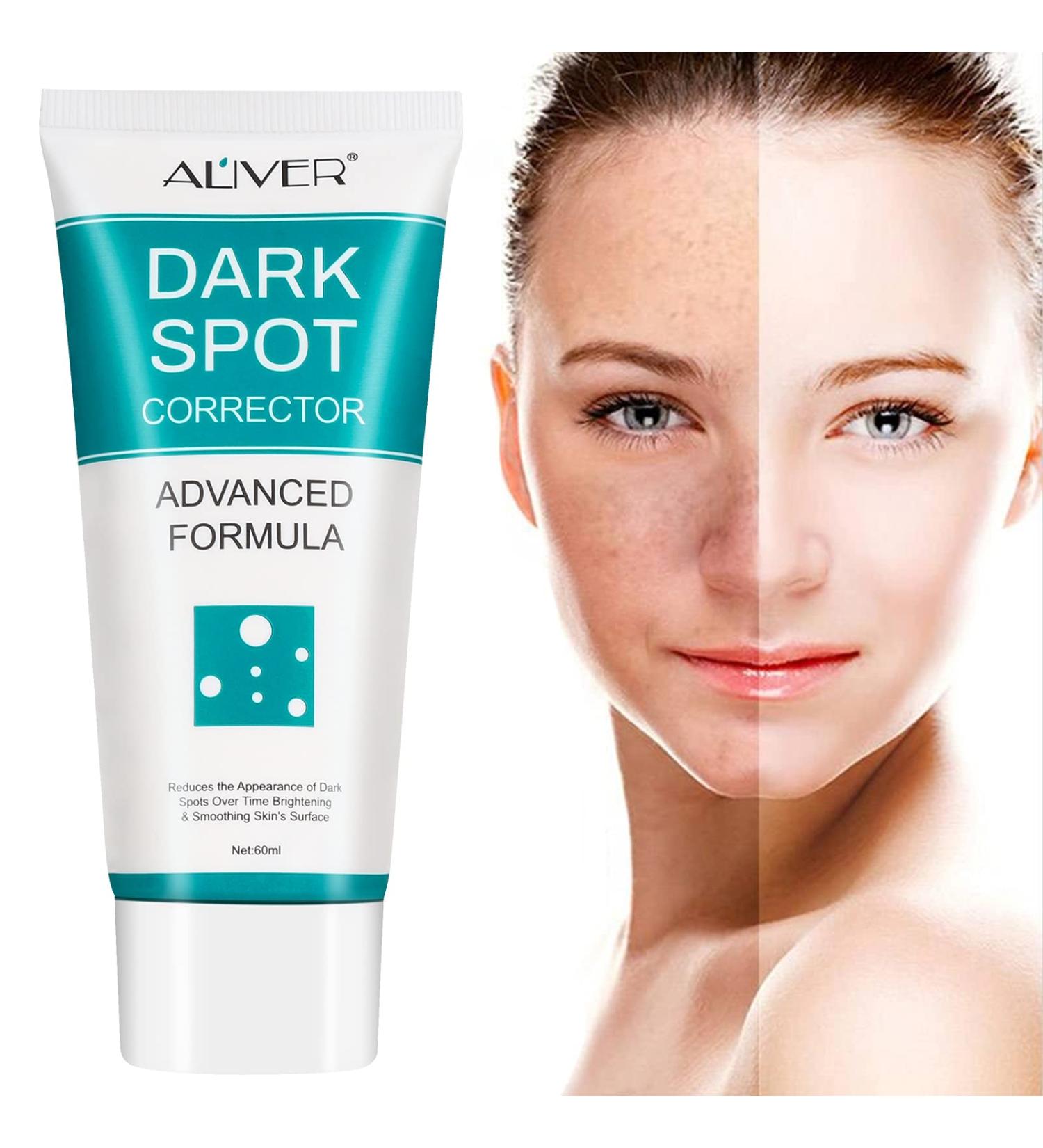 Dark Spot Corrector Cream for Face - Fade Black Precipitates, Remove Freckles & Spots - All Skin Tone Types - Buy Online on GoSupps.com