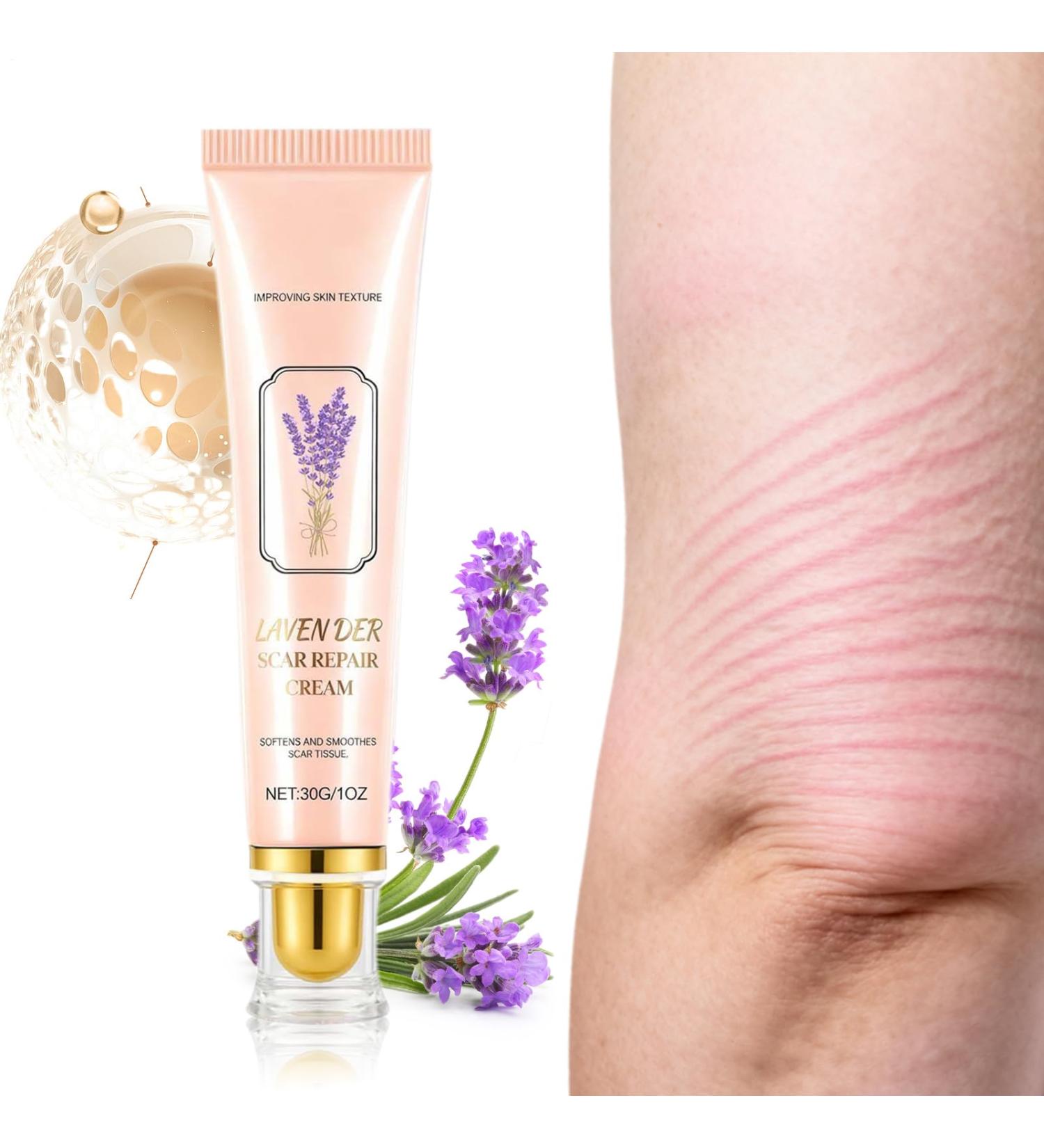  Generisch Scar cream for women | Skin texture improvement compact products | Moisturizing scar removal lotion for men women teens athletes sons daughters - Buy Online on GoSupps.com