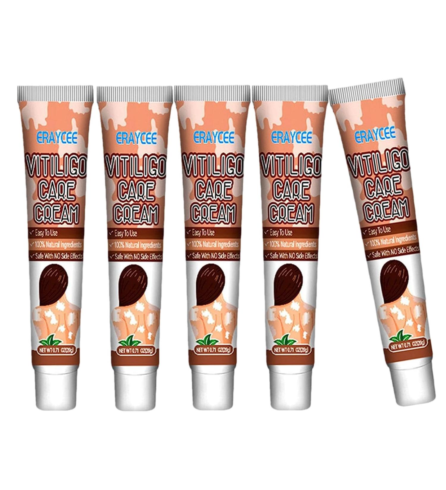 Vitiligo Care Ointment 20g | Repigmentation & Relief Cream | Improves Skin Pigmentation | Easy to Apply | 5-Pack - Buy Online on GoSupps.com