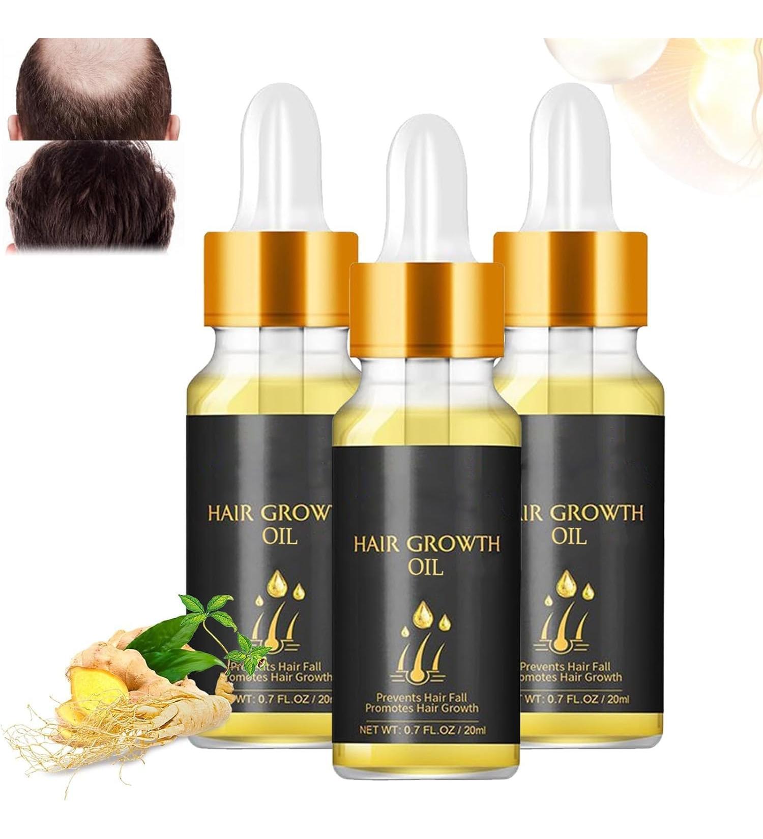 2024 New Folix 22 Hair Growth S rum de croissance des cheveux formule de croissance des cheveux huile de croissance des cheveux biotine s rum paississant base d'herbes huile de croissance des 3 pi ces - Buy Online on GoSupps.com