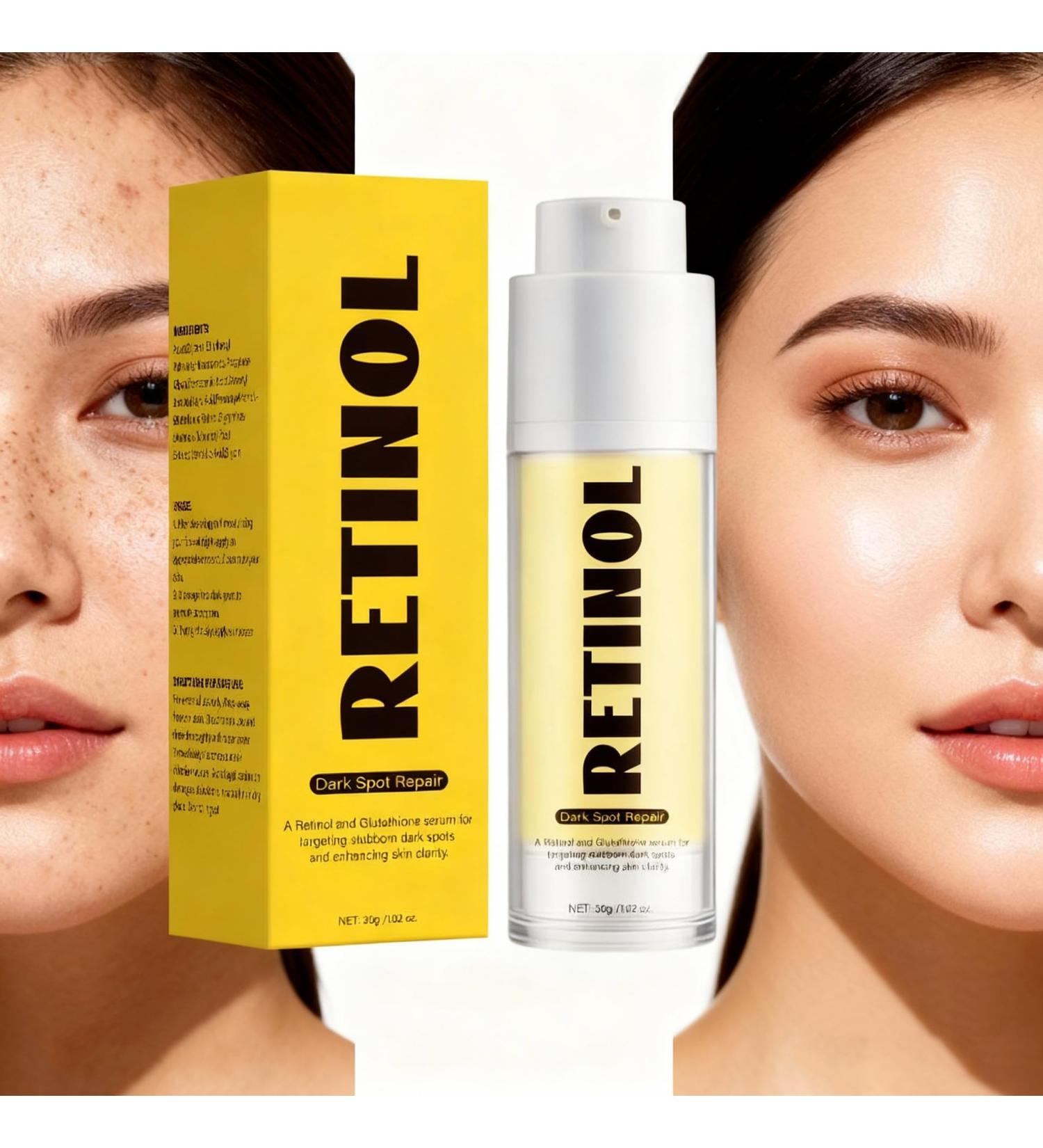 RETINOL & Glutathione Dark Spot Repair Cream (1.06 oz) - Fades Acne Scars & Hyperpigmentation Brightens & Evens Skin Tone Suitable for All Skin Types (2 pcs-RETINOL & Glutathione) - Buy Online on GoSupps.com