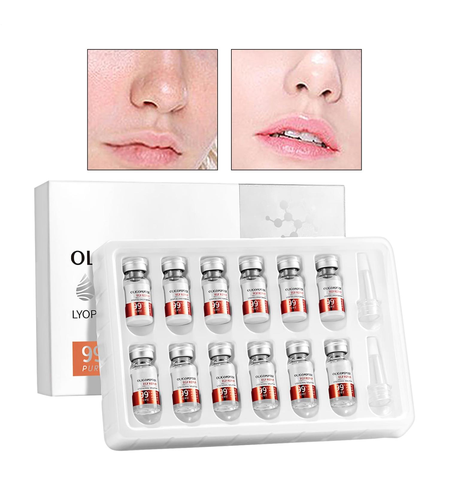 Freeze Dried Face Powder - Repairing Face Powder Damaged Skin Roughness Brightening Moisturizer for the Whole Family Daily Hydration - Buy Online on GoSupps.com