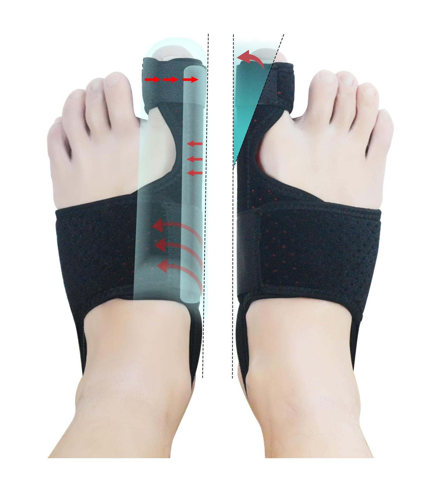 MOONSMILE Bunion Corrector (1 Pair) - Night Bunion Splint & Toe Straightener for Pain Relief - Black - Buy Online on GoSupps.com
