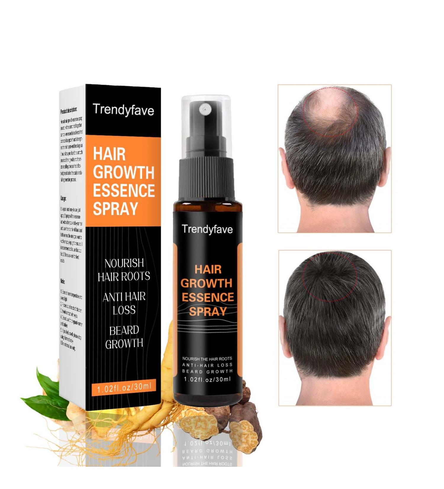 Trendyfave Hair Regrowth Spray Hair Growth Serum Thickening Hair Volume Spray Anti Hair Loss Spray Hair Rapid Growth Spray Natural Ingredients Hair Regrowth Serum Repair Hair Follicles -30ML - Buy Online on GoSupps.com