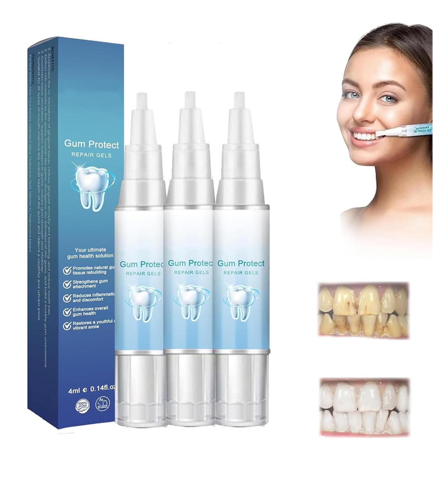 Buy Gums Therapy Gel - 3 Piece Gum Shield for Repair Swelling Relief & Teeth Whitening | International Shipping Available - Buy Online on GoSupps.com